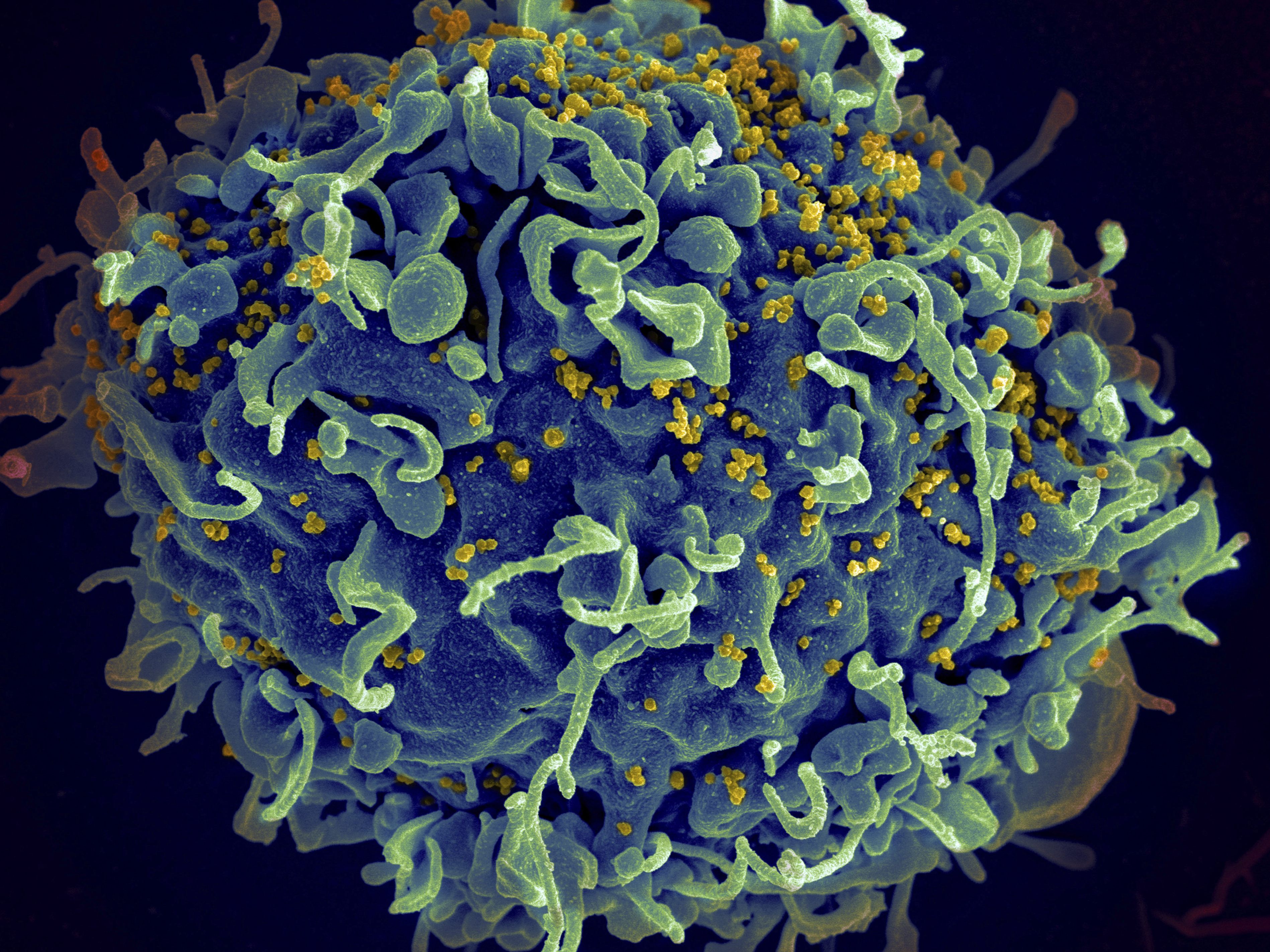 Der Kampf gegen das HIV-Virus stockte unter anderem wegen Corona. Der Kampf gegen das HIV-Virus stockte unter anderem wegen Corona.