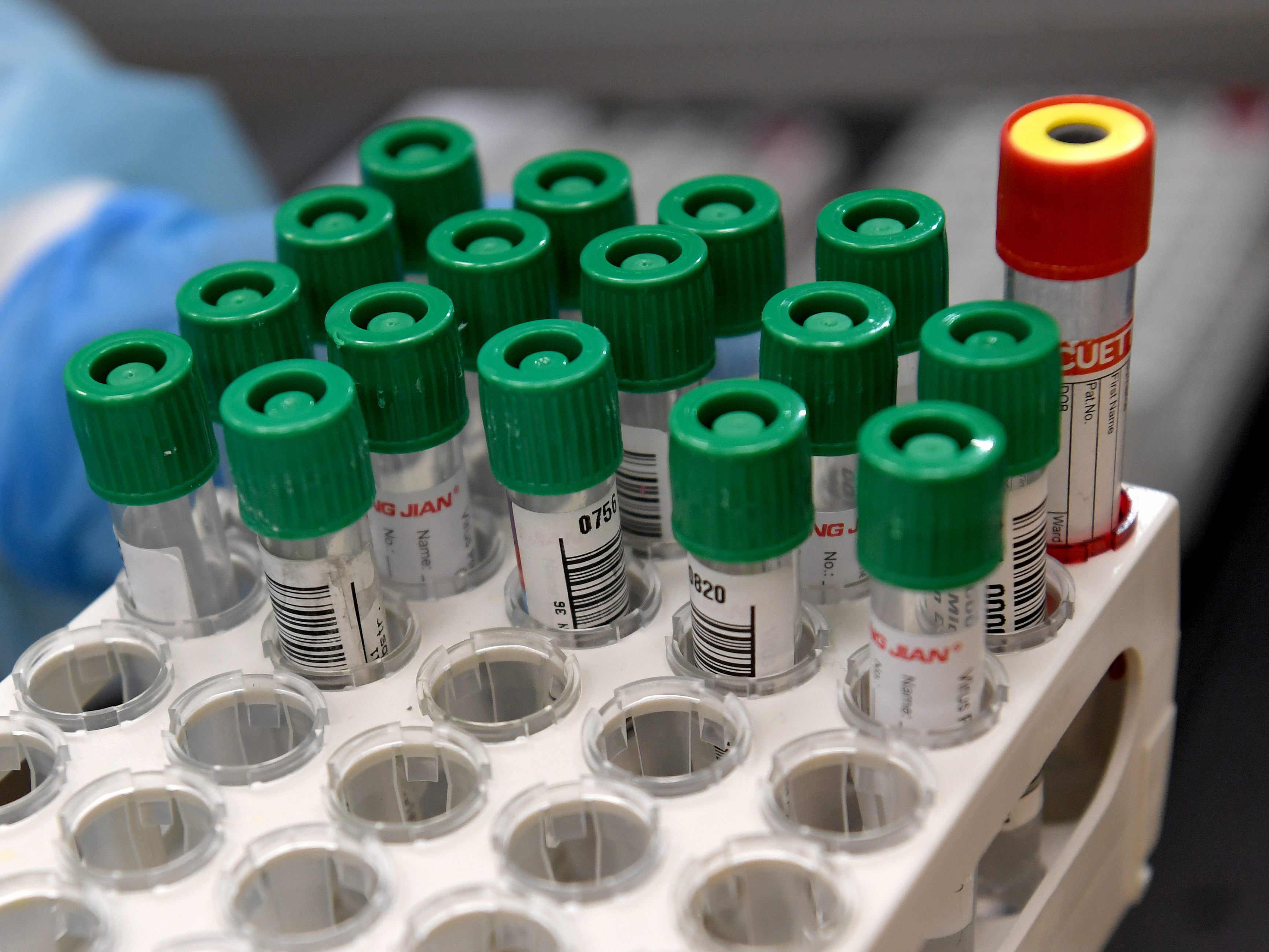 3.831 Neuinfektionen mit dem Coronavirus wurden am Sonntag in Österreich gemeldet. 3.831 Neuinfektionen mit dem Coronavirus wurden am Sonntag in Österreich gemeldet.
