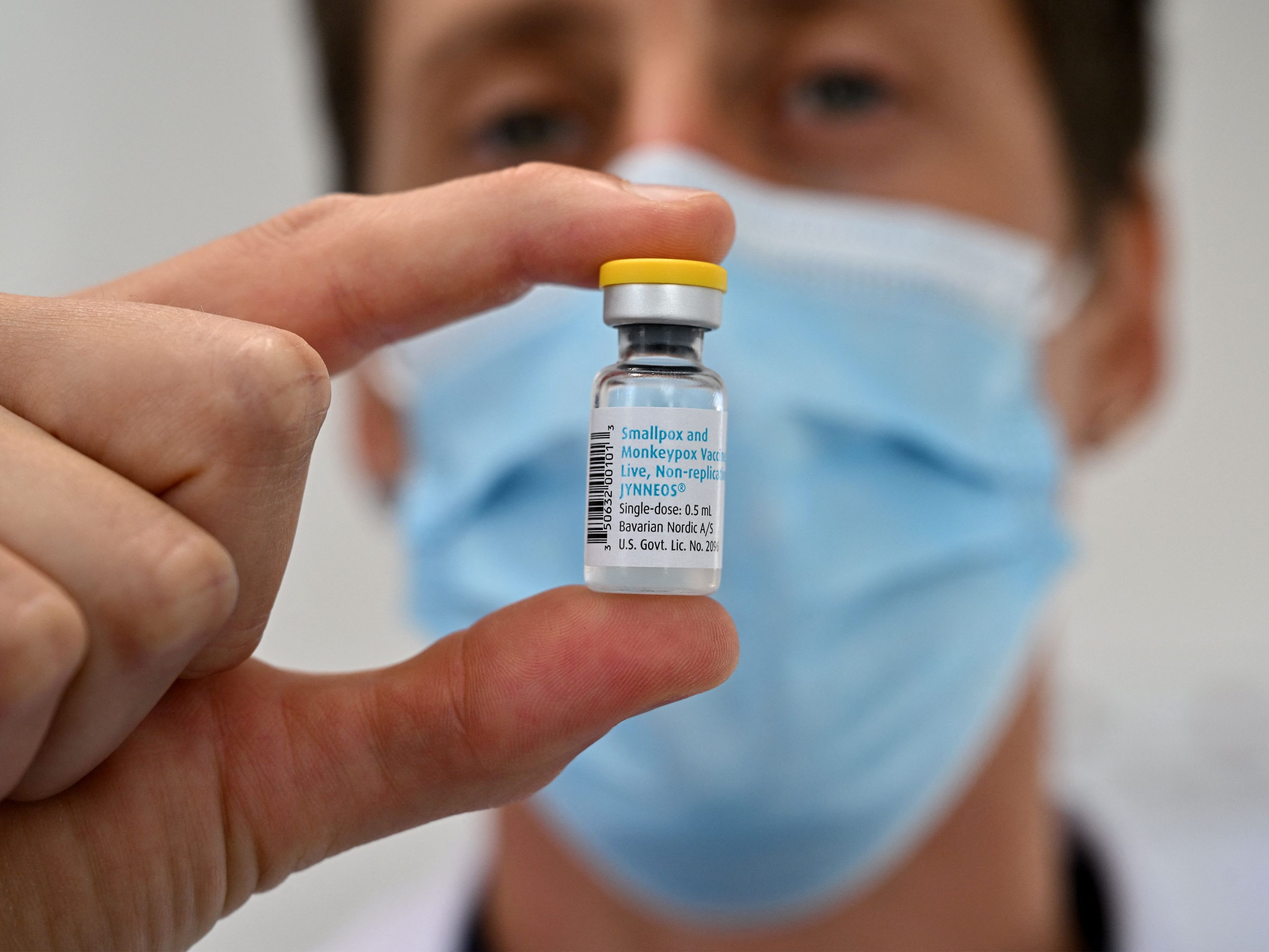 In Österreich hat es noch keine Todesfälle mit dem Affenpocken-Virus gegeben.
