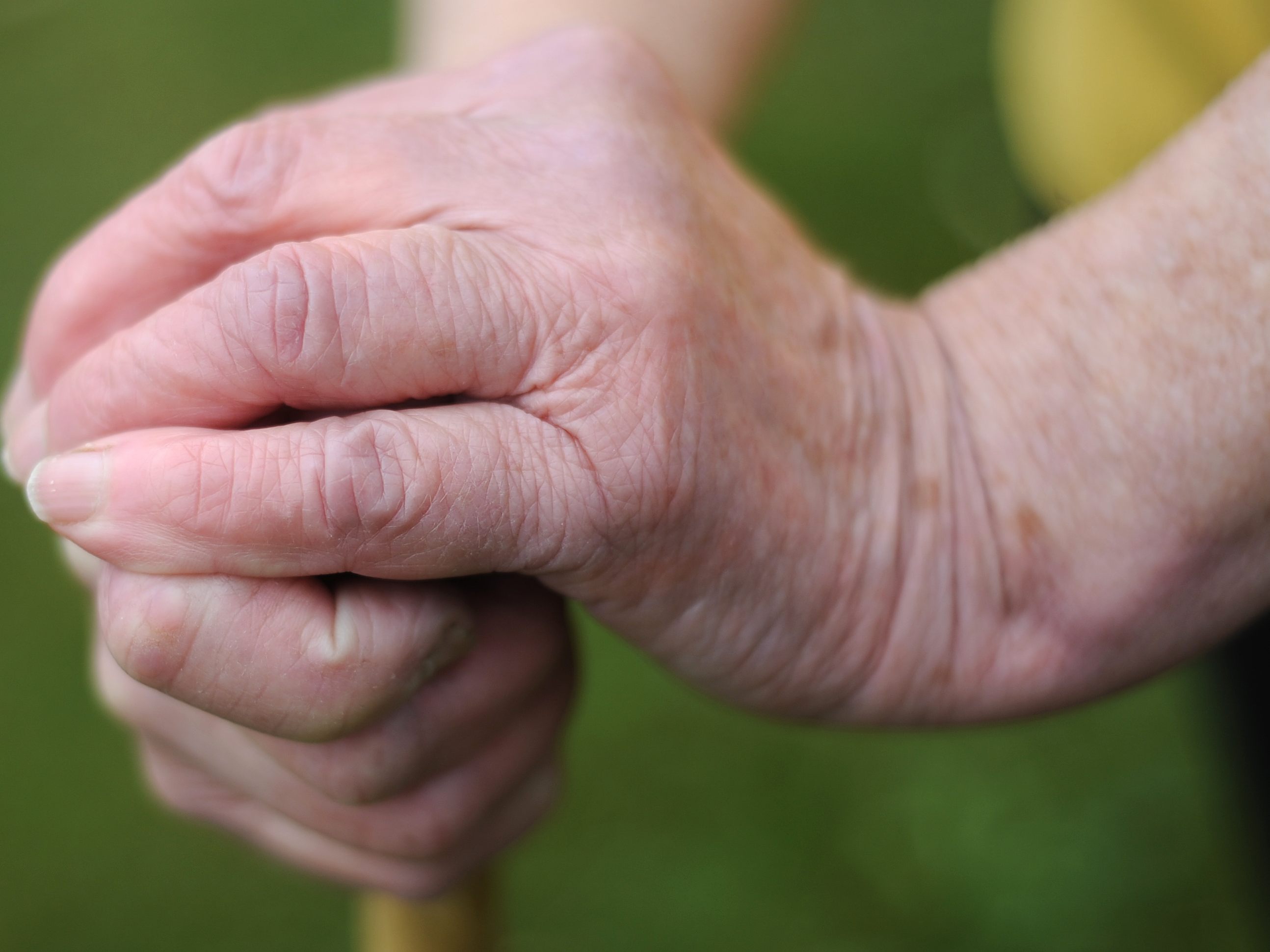 Die Ermittlungen nach dem Tod von Pflegeheimbewohnern in NÖ wurden eingestellt.