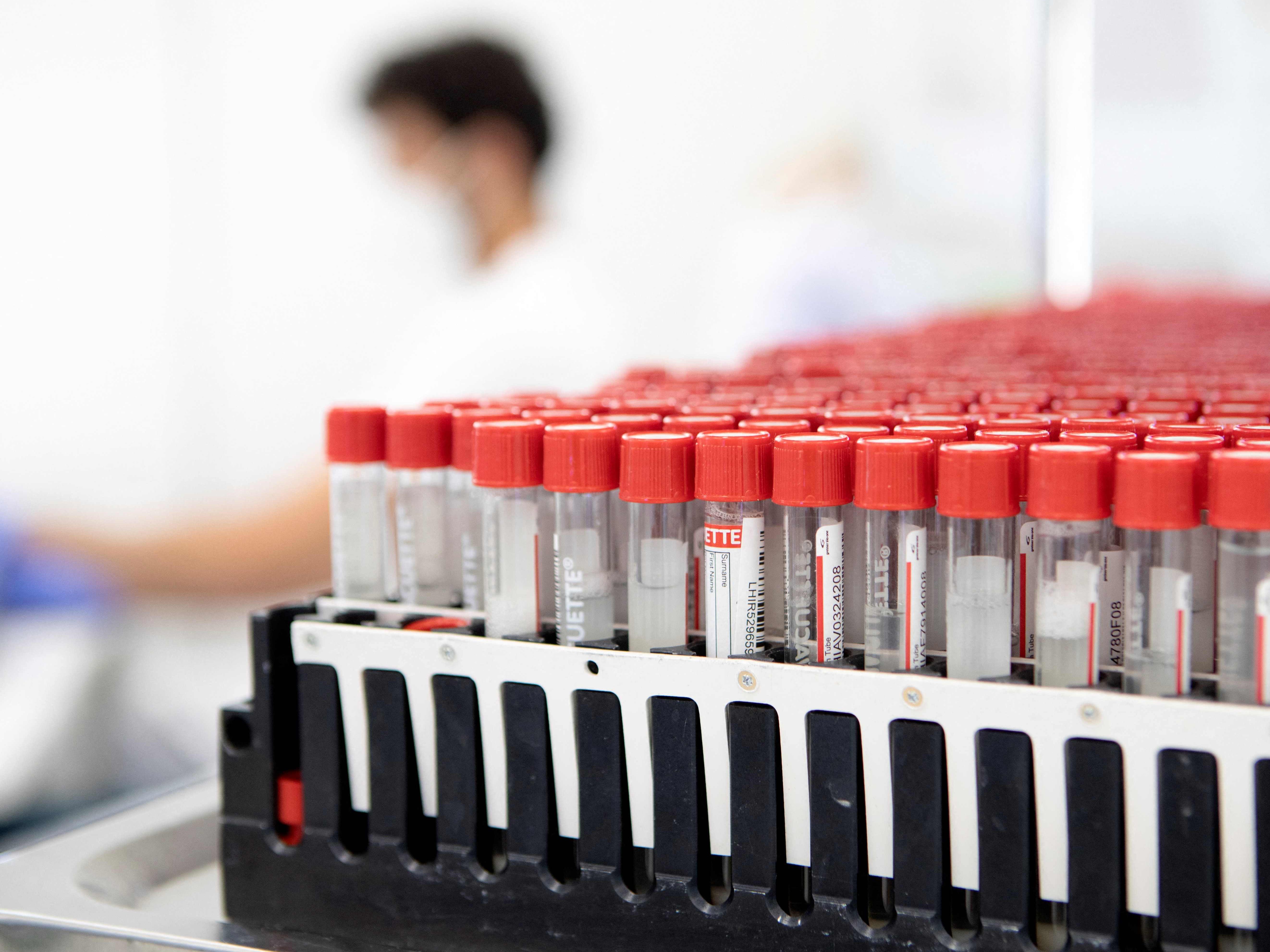 Am Montag wurden 8.299 Neuinfektionen mit dem Coronavirus gemeldet. Am Montag wurden 8.299 Neuinfektionen mit dem Coronavirus gemeldet.