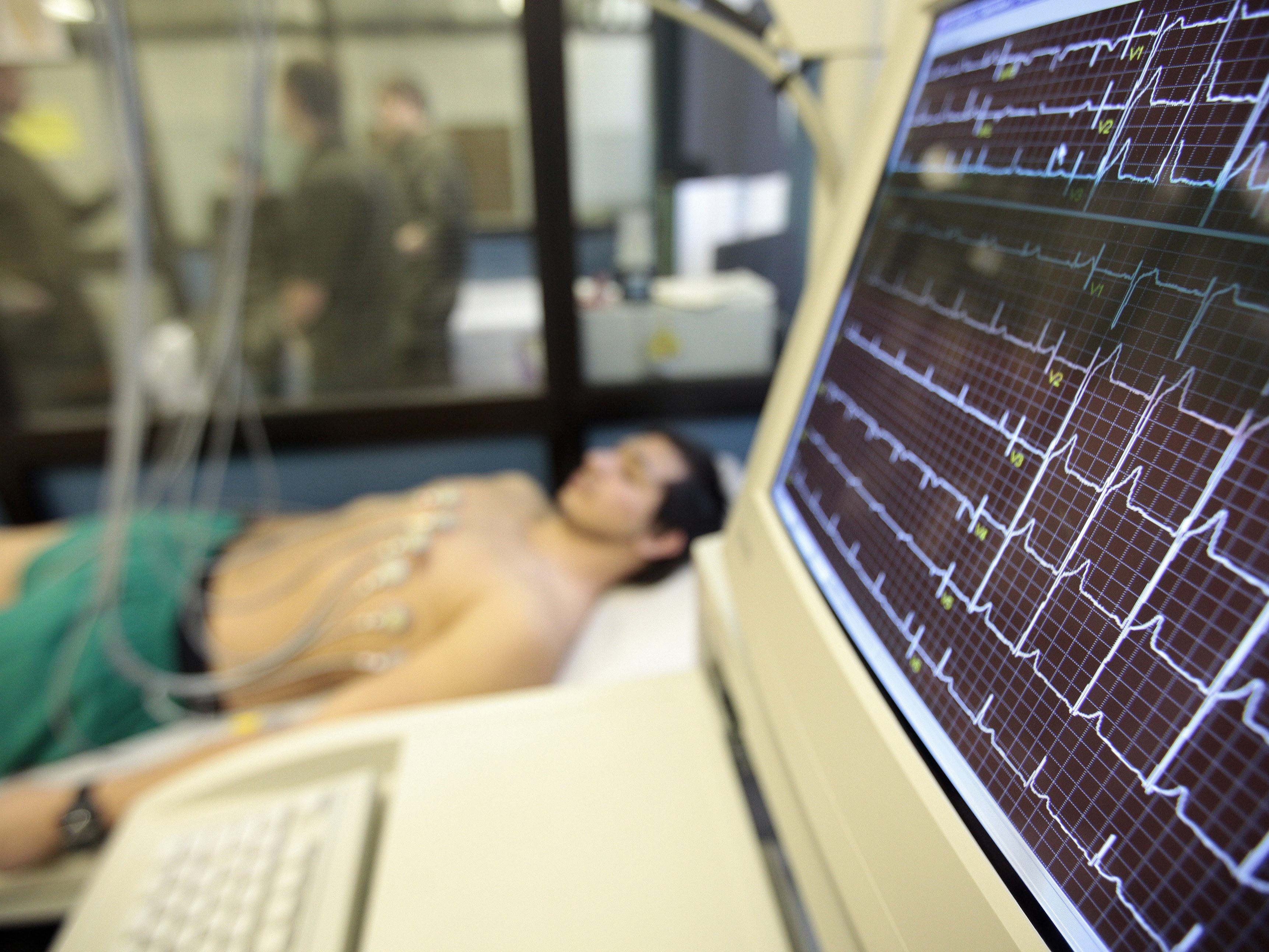 Long Covid umfasst am häufigsten Herzprobleme und das chronische Fatigue-Syndrom.