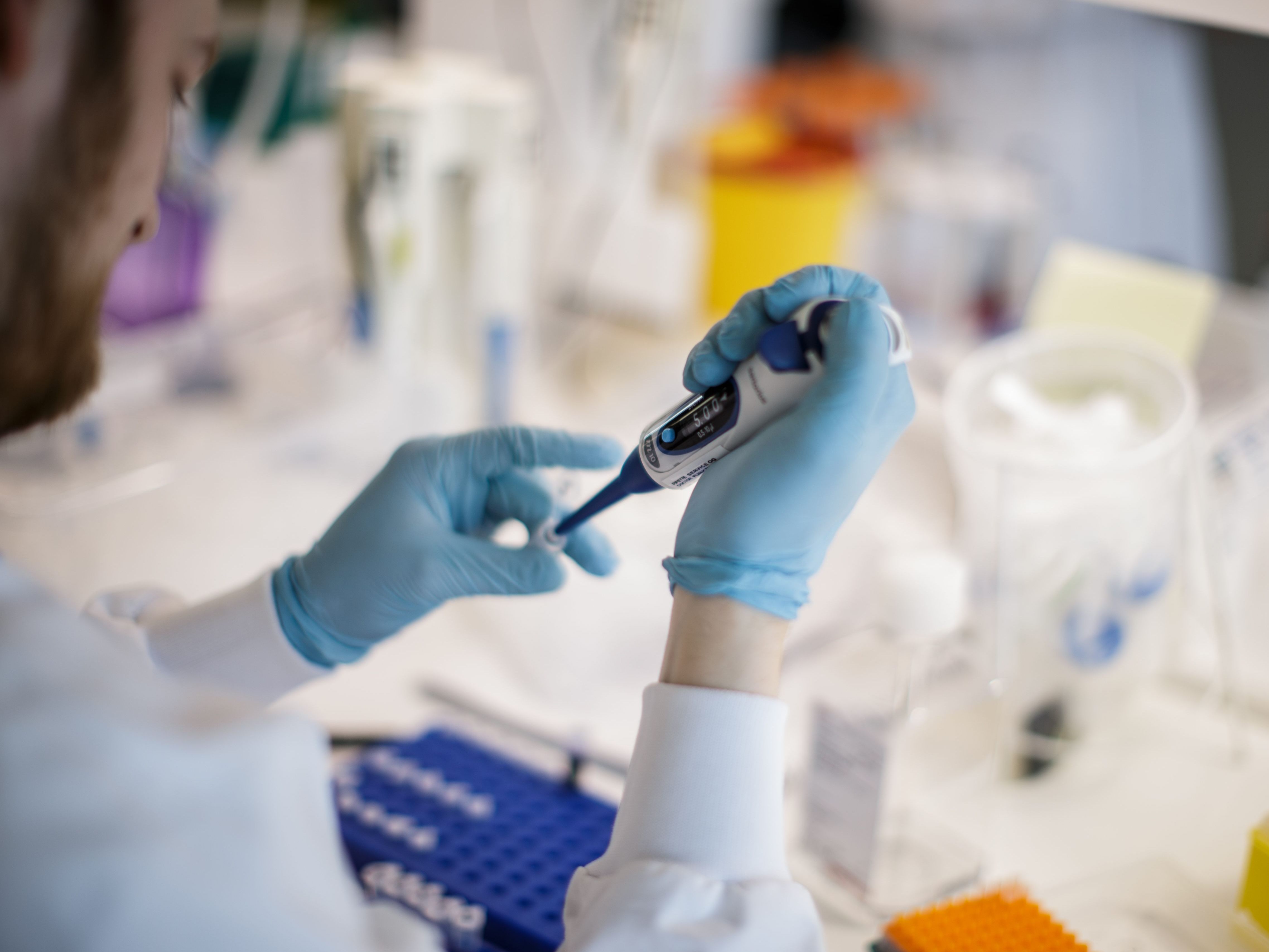 Forscher hoffen, dass ein Bananenprotein Universalmittel gegen Coronaviren sein könnte.