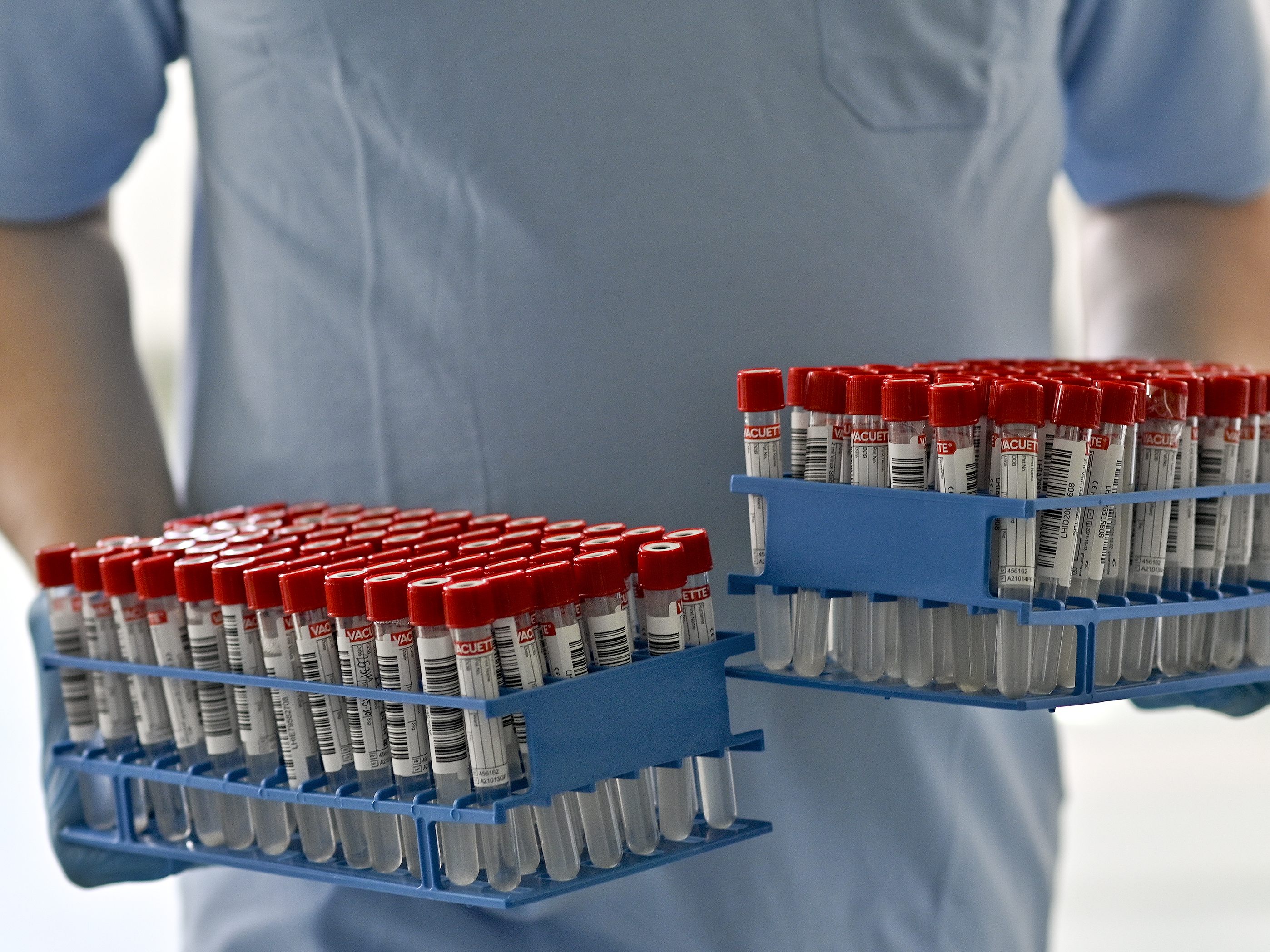 Rund 1.700 Corona-Neuinfektionen wurden am Sonntag detektiert. Rund 1.700 Corona-Neuinfektionen wurden am Sonntag detektiert.