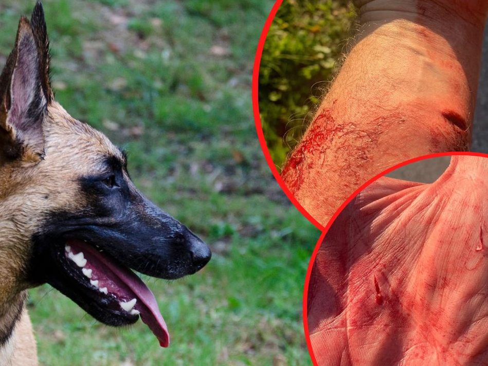 Klaus: Nach über zehn angezeigten Hundeattacken spricht nun ein Opfer für den Kampf mit dem Tier. Klaus: Nach über zehn angezeigten Hundeattacken spricht nun ein Opfer für den Kampf mit dem Tier.