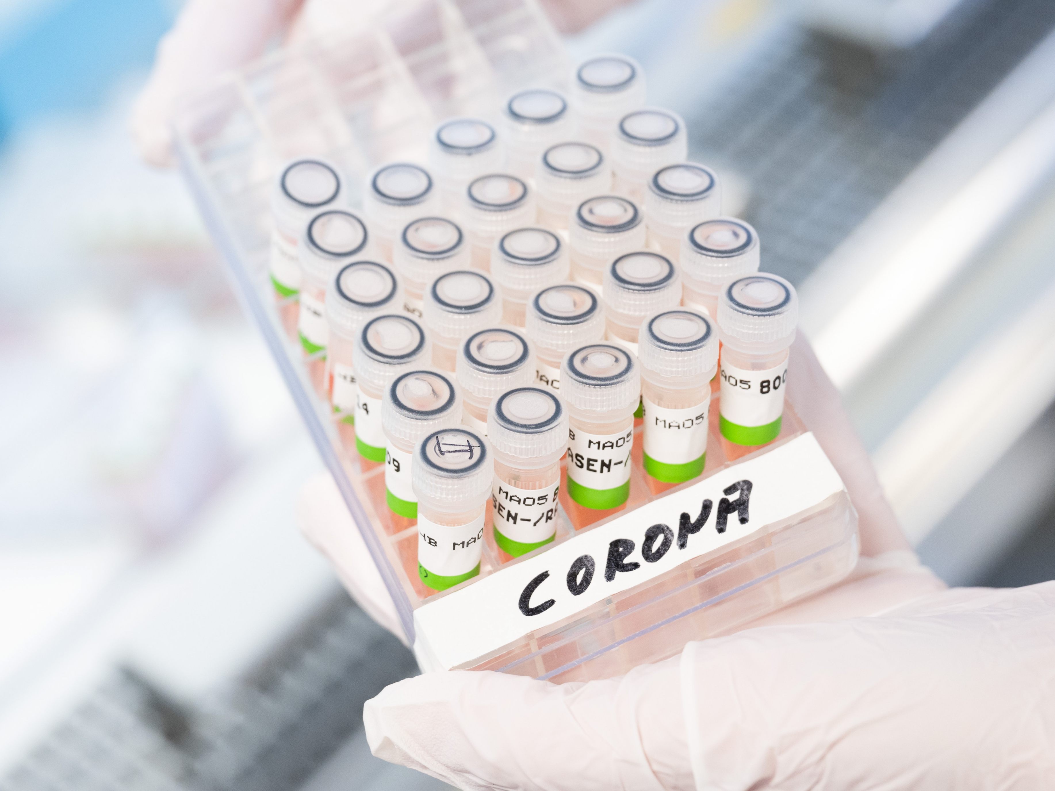 Das Prognosekonsortium geht von einem weiteren Corona-Rückgang auf den Normalstationen aus.