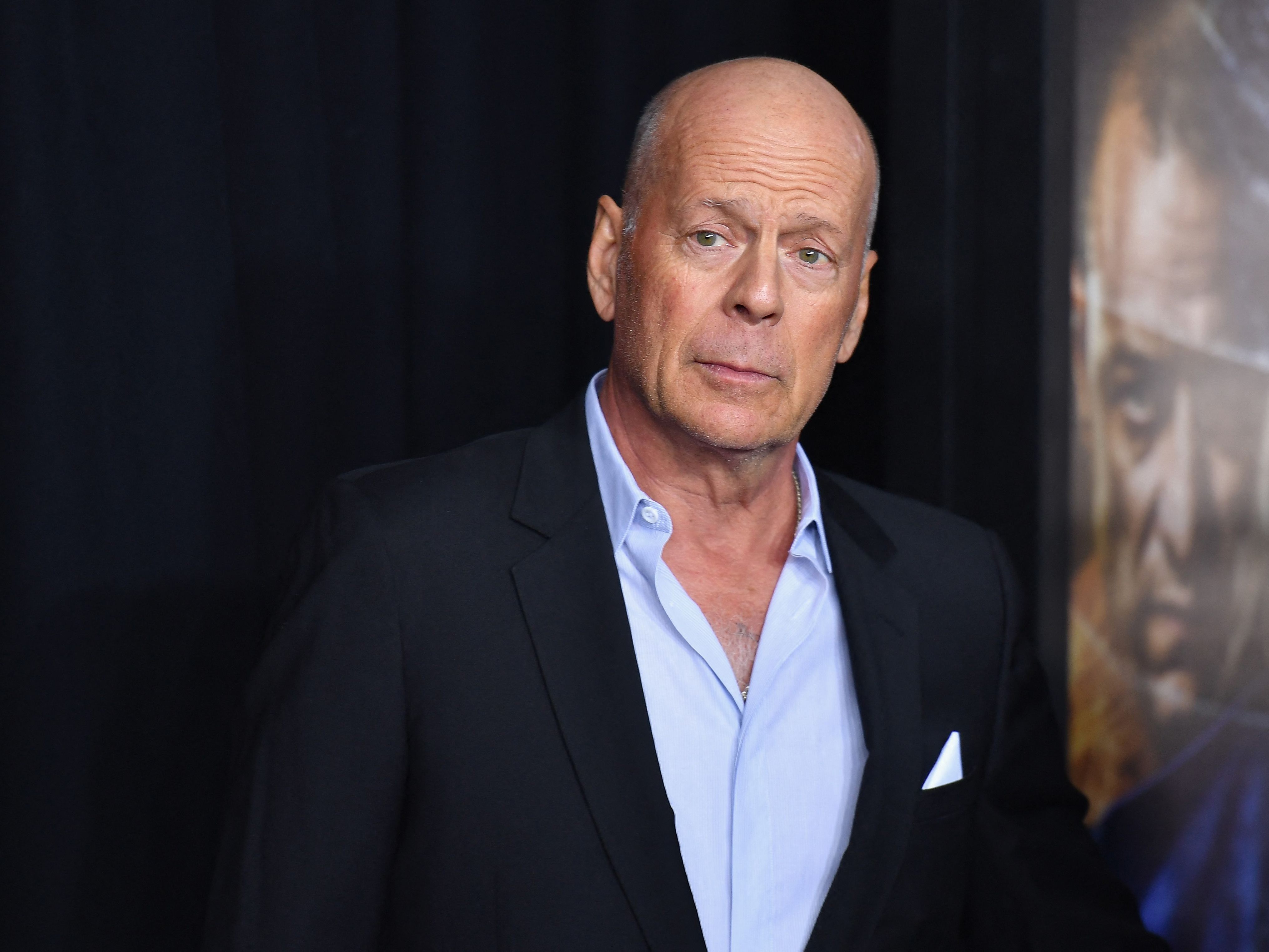 Bruce Willis leidet an Demenz.