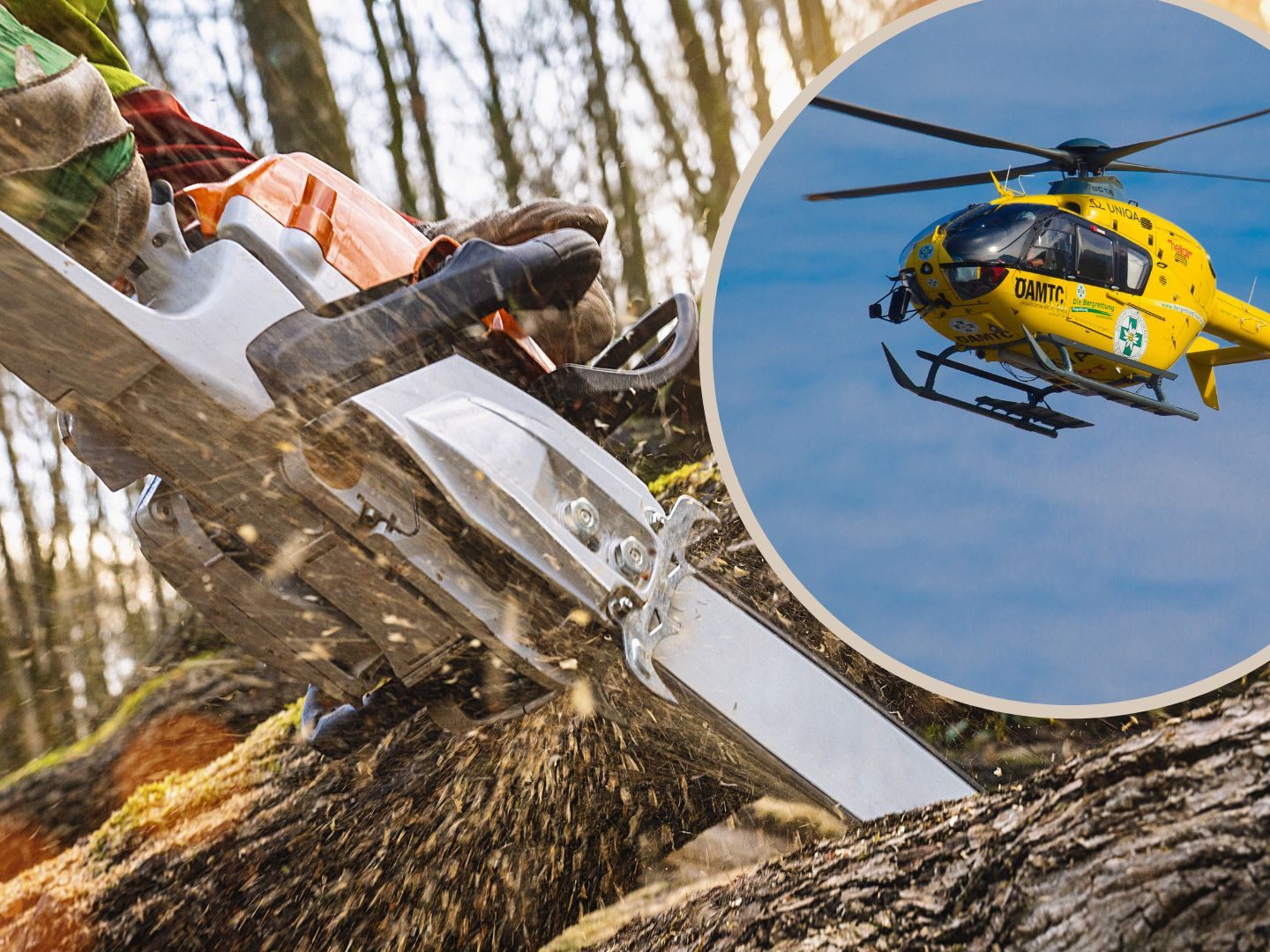 27-Jähriger bei Holzarbeiten verletzt