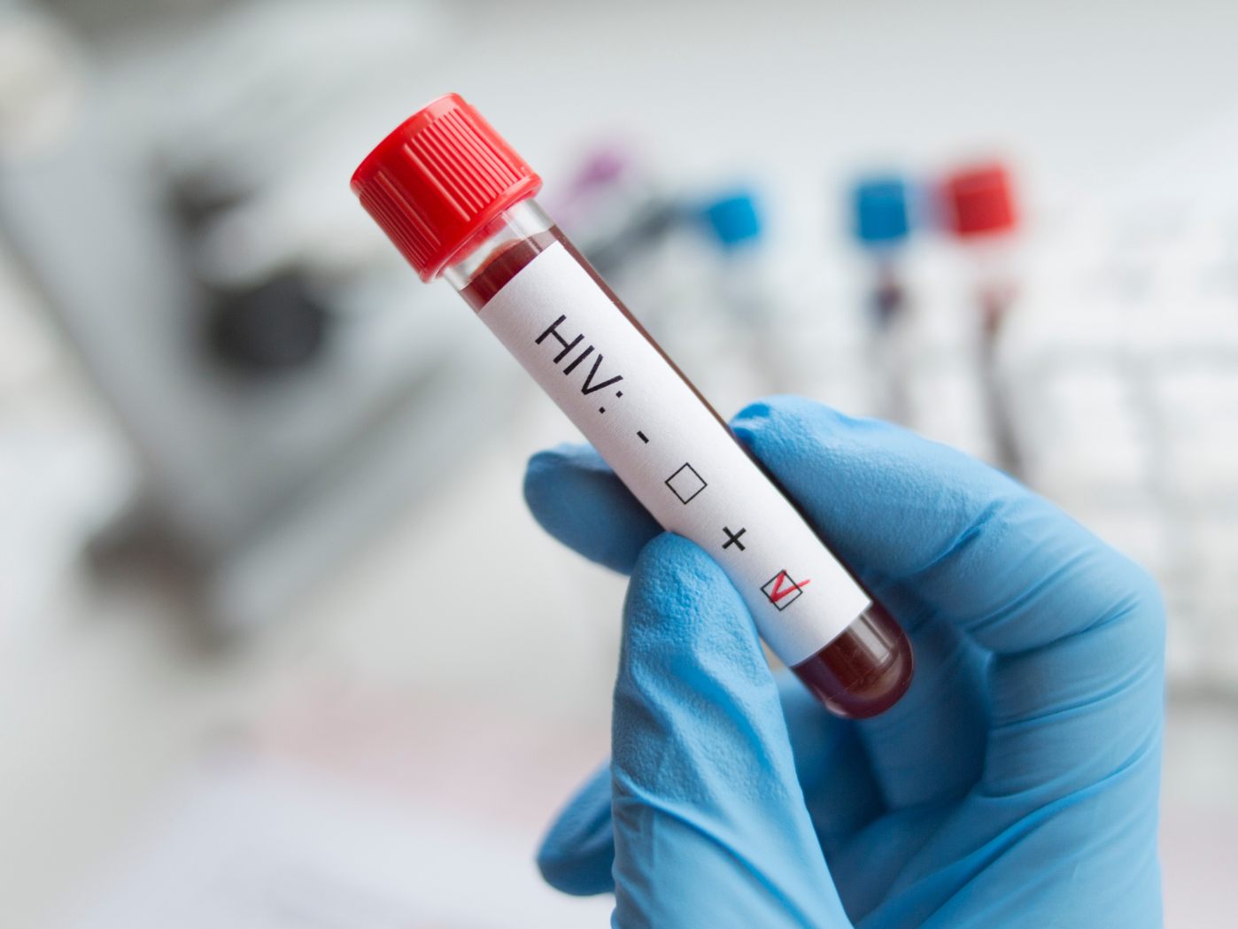 HIV-Infektionen steigen laut Tiroler “Aids-Hilfe” an - Gesundheit - VIENNA.AT