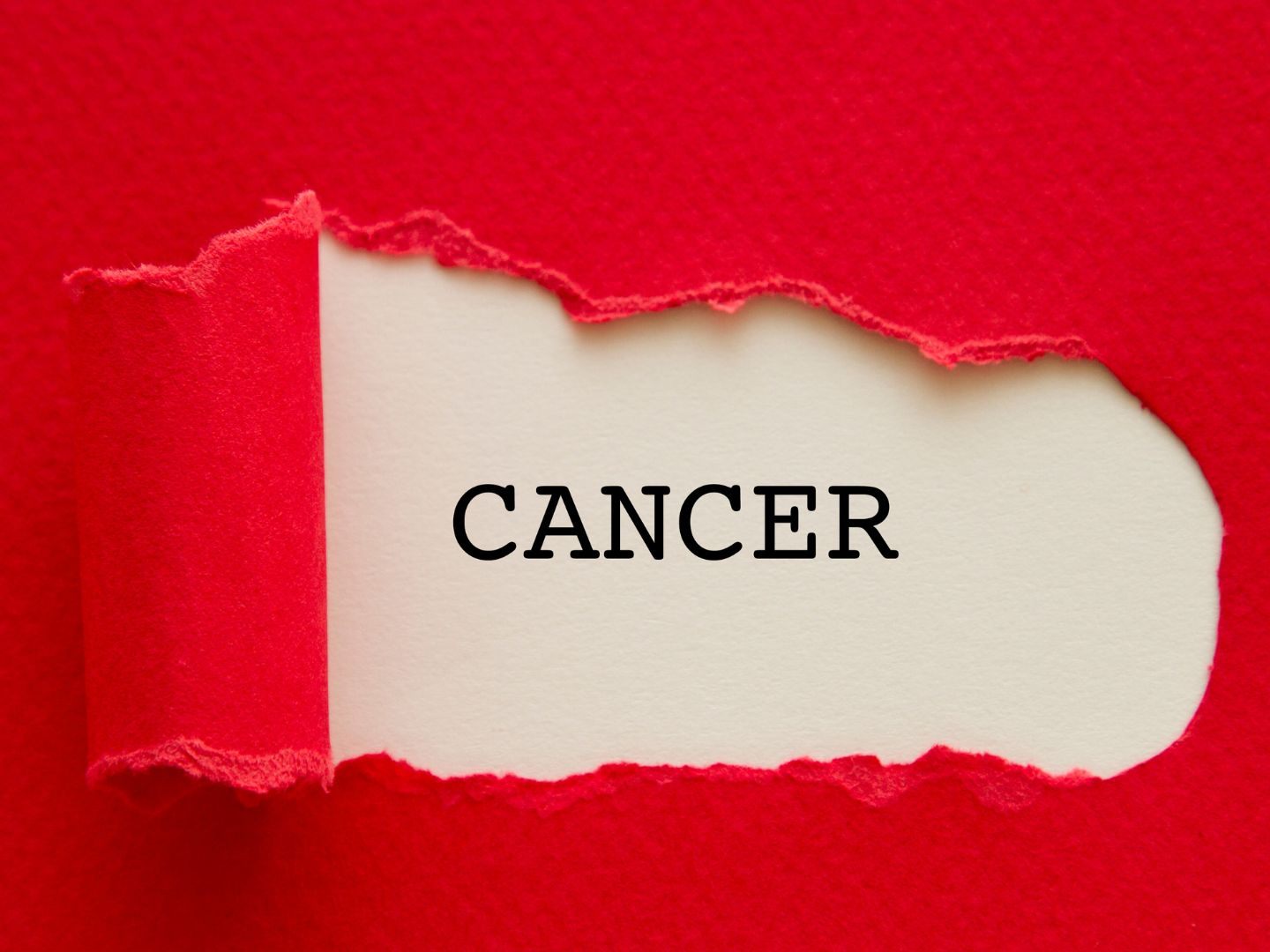 Forderung nach Etablierung der Cancer Nurse. Forderung nach Etablierung der Cancer Nurse.