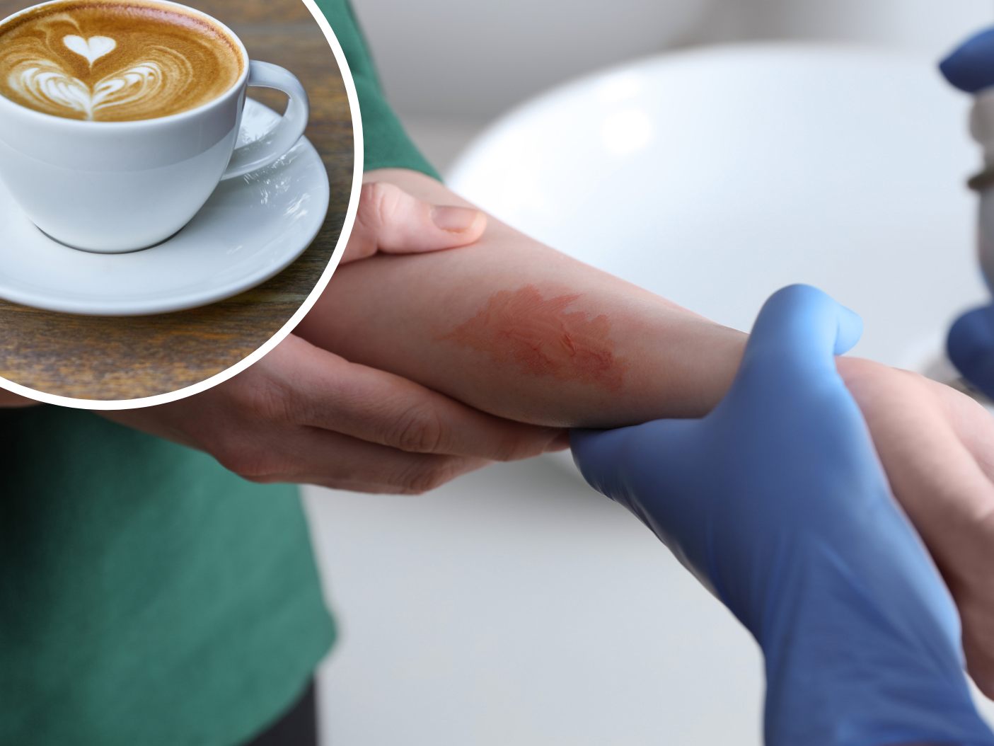 Nach einer Verbrühung mit Kaffee in einem Flugzeug bekommt ein Mann keinen Schadenersatz.