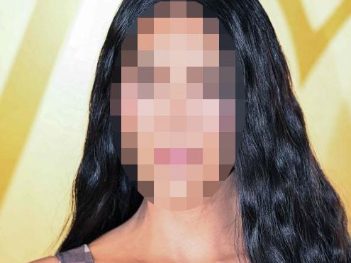 Fans sind geschockt von Kardashians Gesicht.