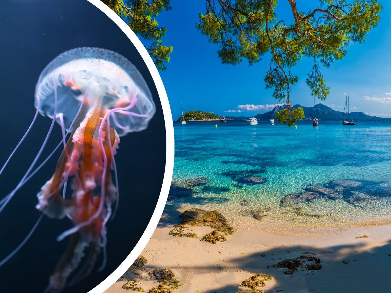Für ein paar Urlauber hatte das Zusammentreffen mit den Quallen schmerzhafte Folgen. Für ein paar Urlauber hatte das Zusammentreffen mit den Quallen schmerzhafte Folgen.