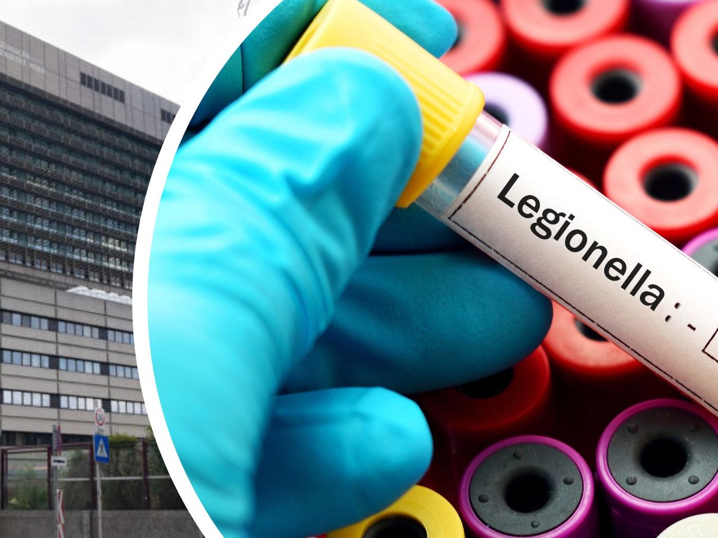 Jene 82-Jährige die im Wiener AKH an einer Legionellen-Infektion verstorben ist, dürfte sich nicht im Spital angesteckt haben.