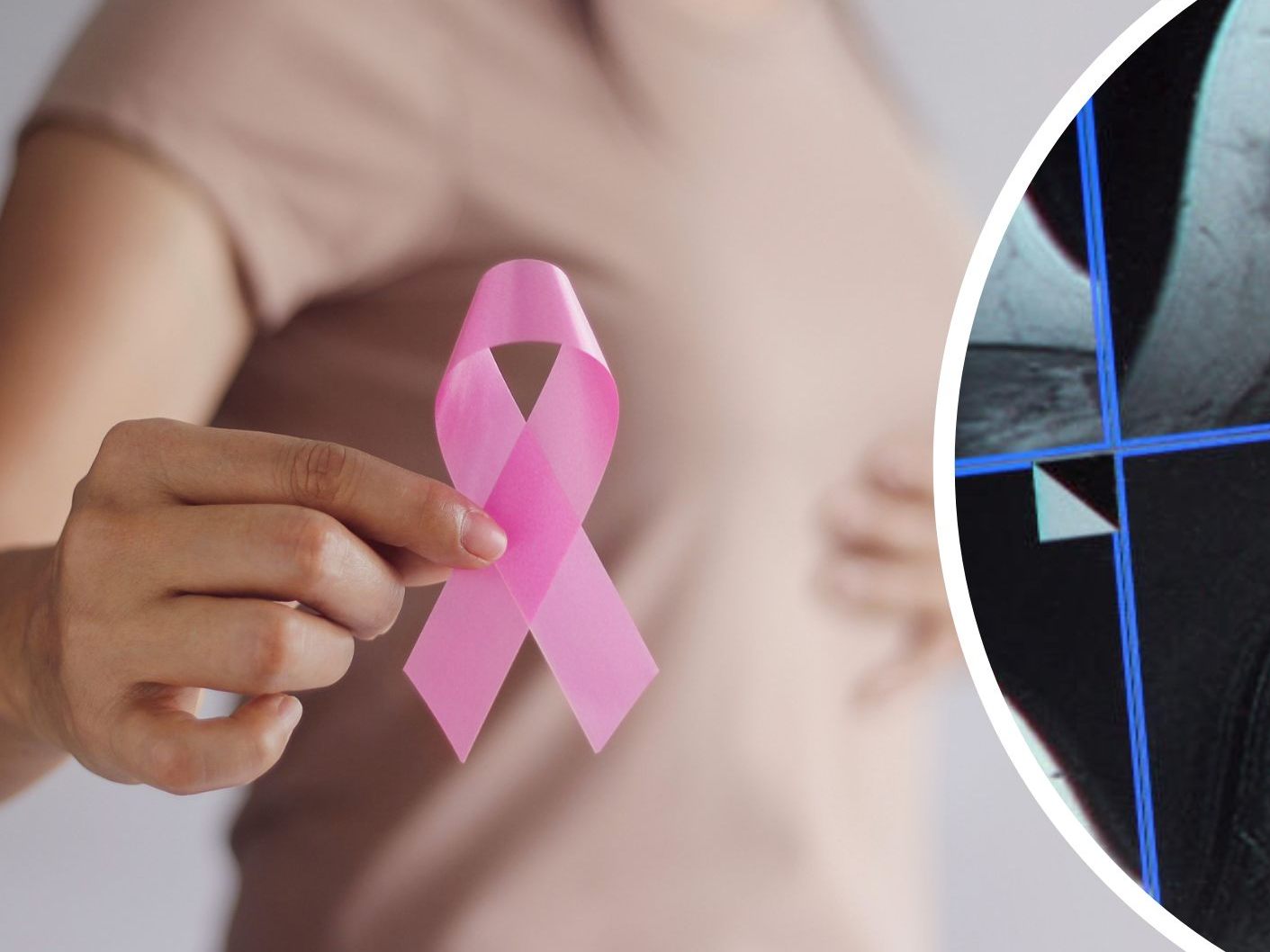 Zum Brustkrebs-Monat Oktober machen Ärzte darauf aufmerksam, dass die eine frühe Diagnose bei der Therapie hilfreich sein kann.