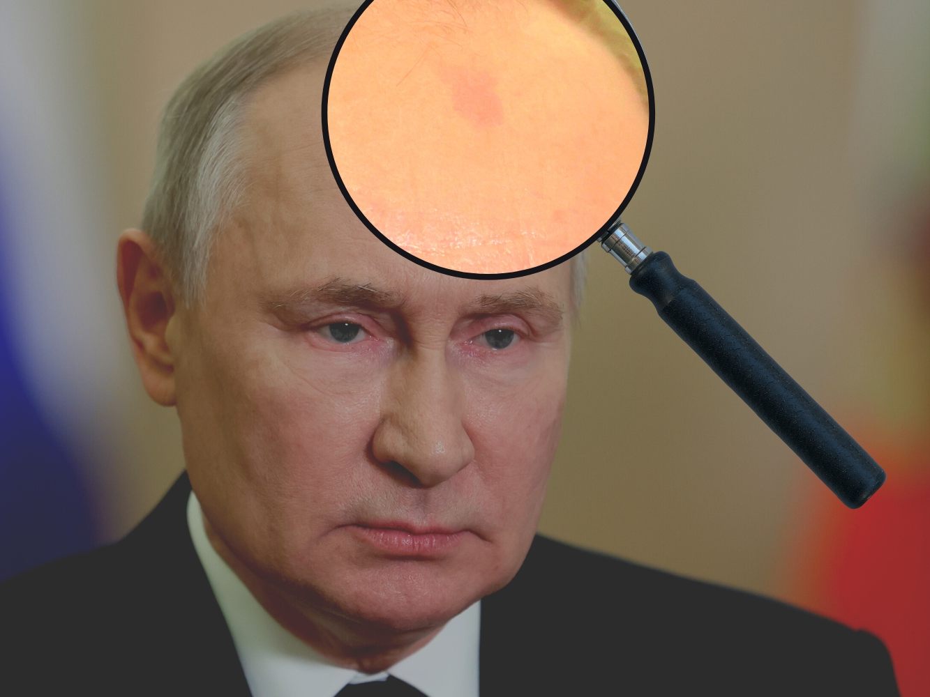 Putins mysteriöser Fleck auf der Stirn Putins mysteriöser Fleck auf der Stirn
