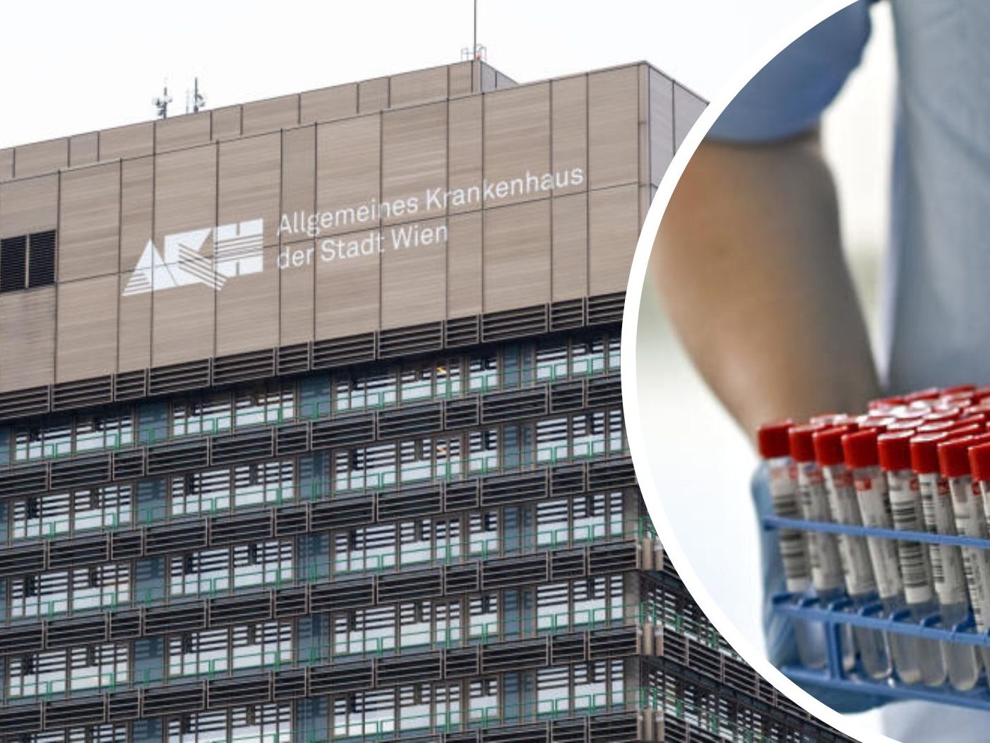 Das AKH Wien testet ab Dienstag stationäre Patienten auf das Coronavirus.