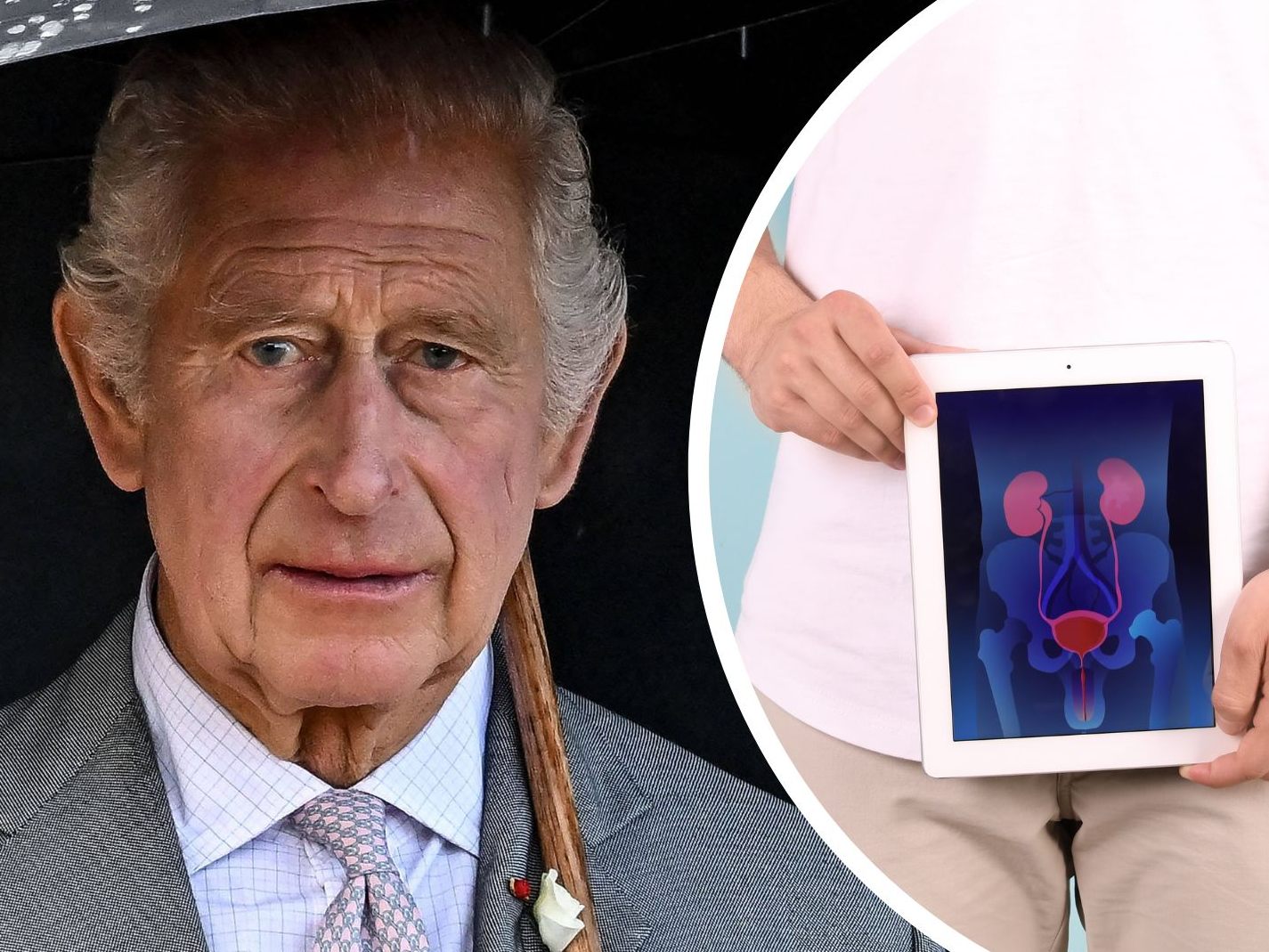 Warum König Charles bald ins Spital muss.