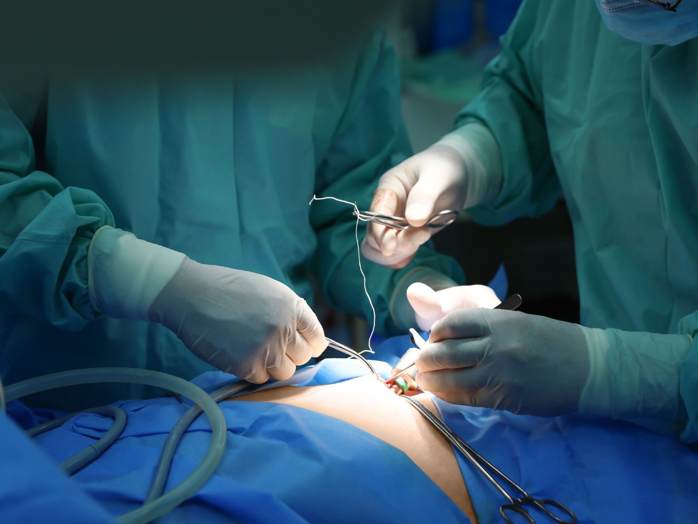 ierstündige Operation in Bari - Patientin wohlauf ierstündige Operation in Bari - Patientin wohlauf