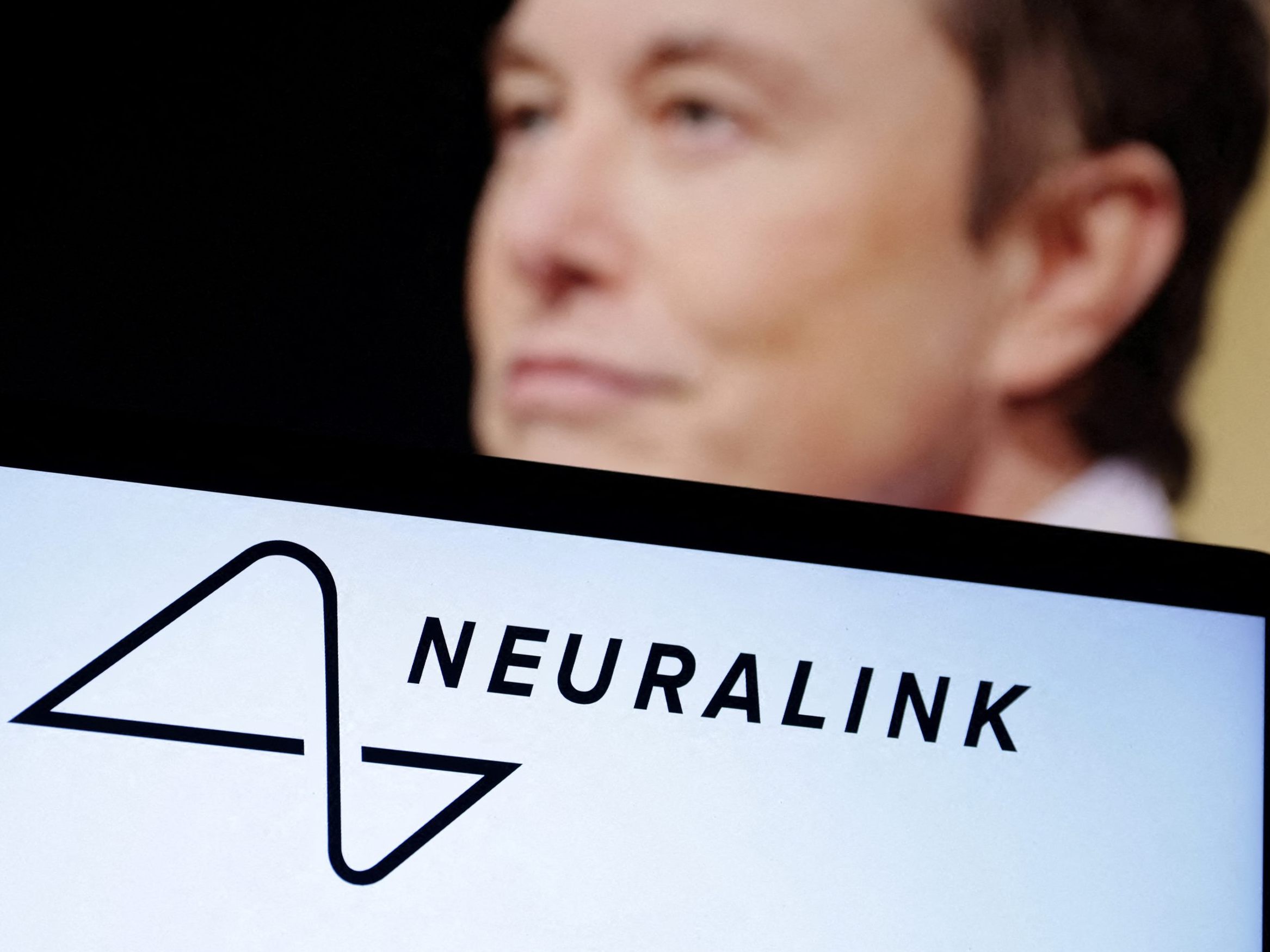 Elon Musk meldete einen Erfolg bei der Verpflanzung eines Gehirnchips. Elon Musk meldete einen Erfolg bei der Verpflanzung eines Gehirnchips.