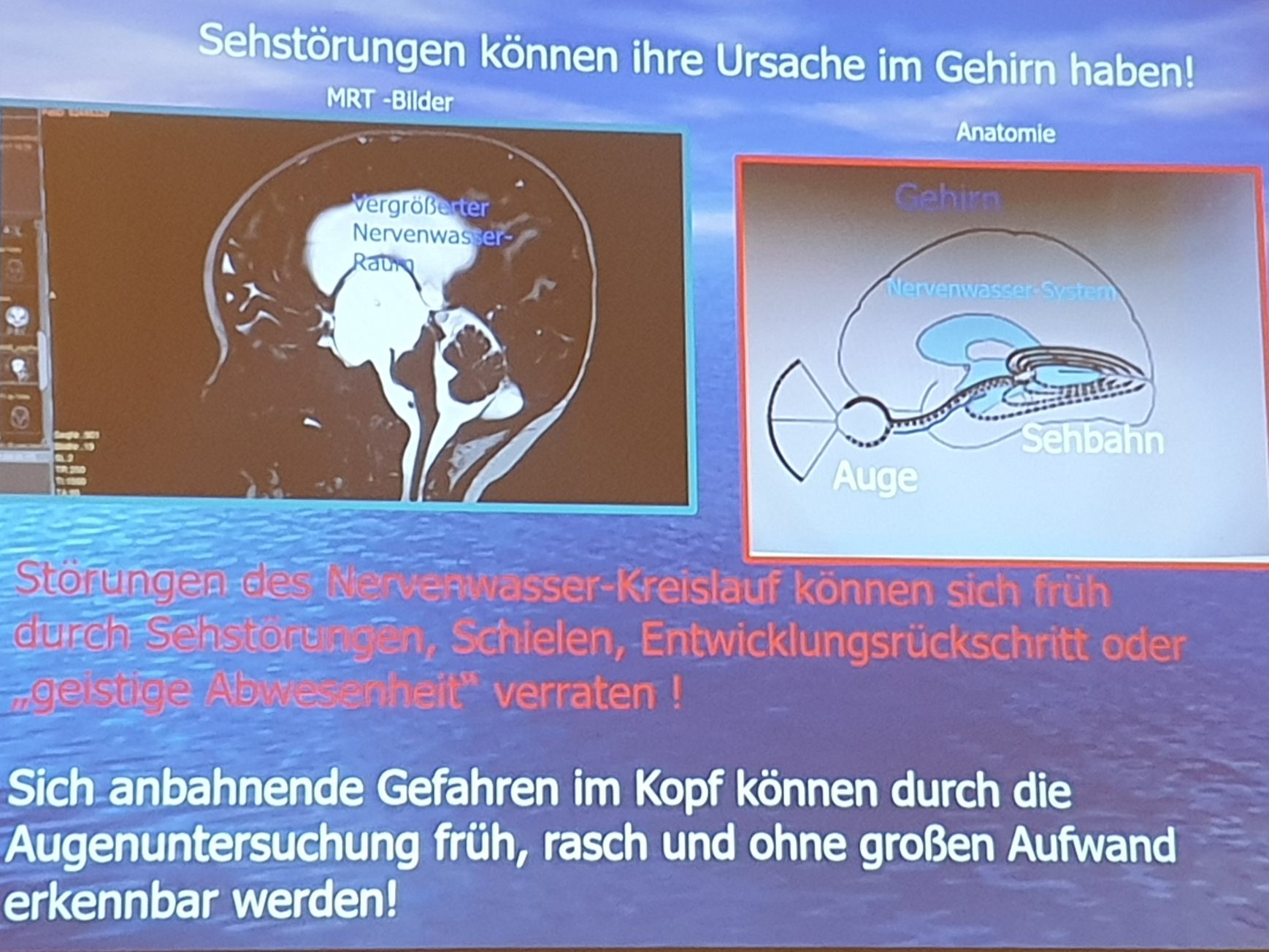 Augengesundheit