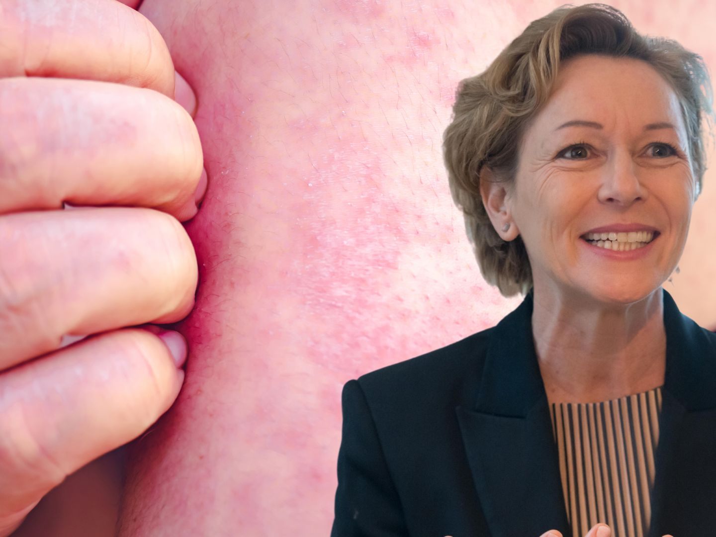 Wie Landesrätin Rüscher bekannt gibt, wurden in Vorarlberg zwei weitere Masernfälle verzeichnet. Wie Landesrätin Rüscher bekannt gibt, wurden in Vorarlberg zwei weitere Masernfälle verzeichnet.