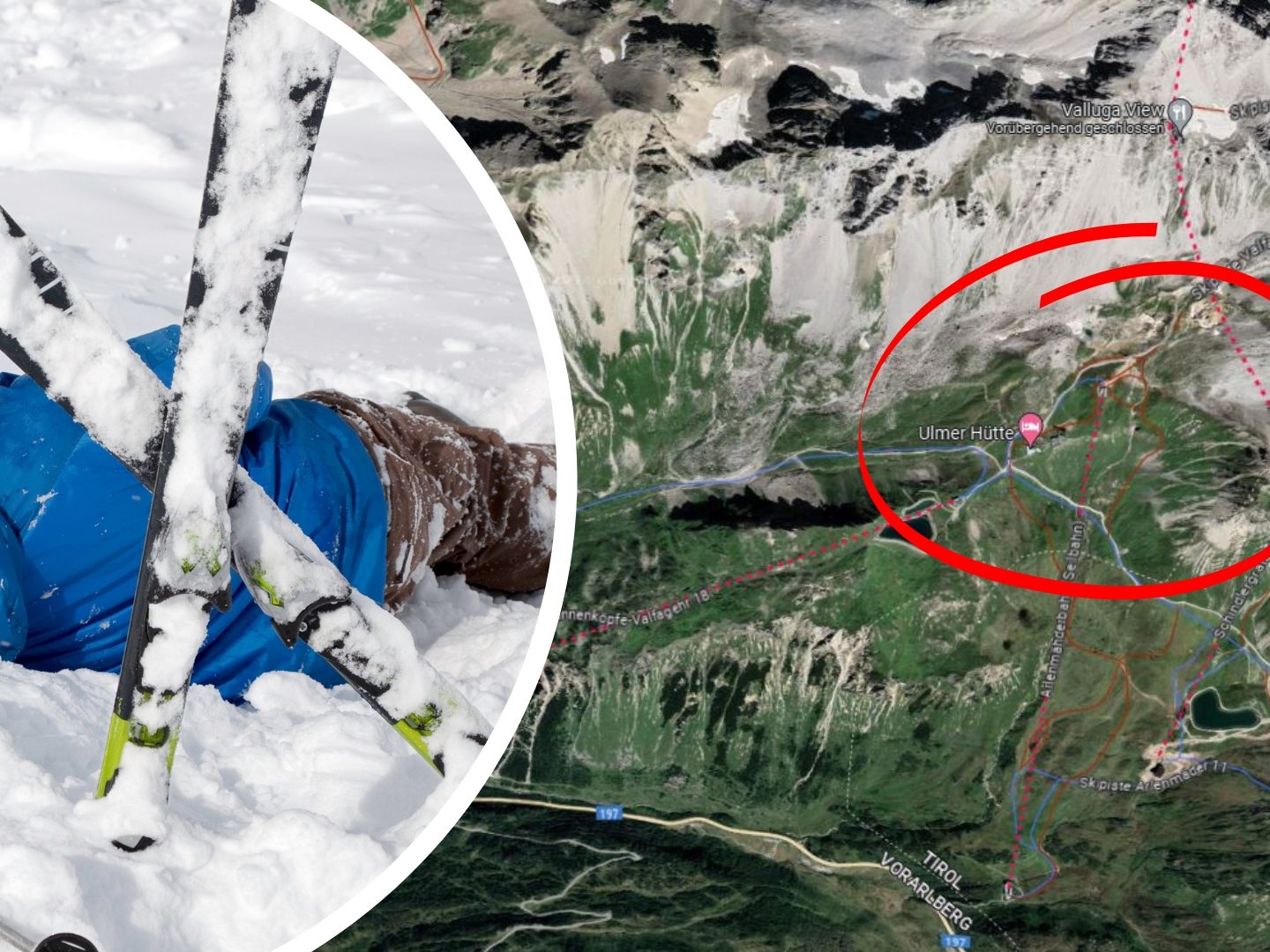 Eine Person wurde bei dem Schiunfall an der Schulter verletzt. (Symbolbild) Eine Person wurde bei dem Schiunfall an der Schulter verletzt. (Symbolbild)