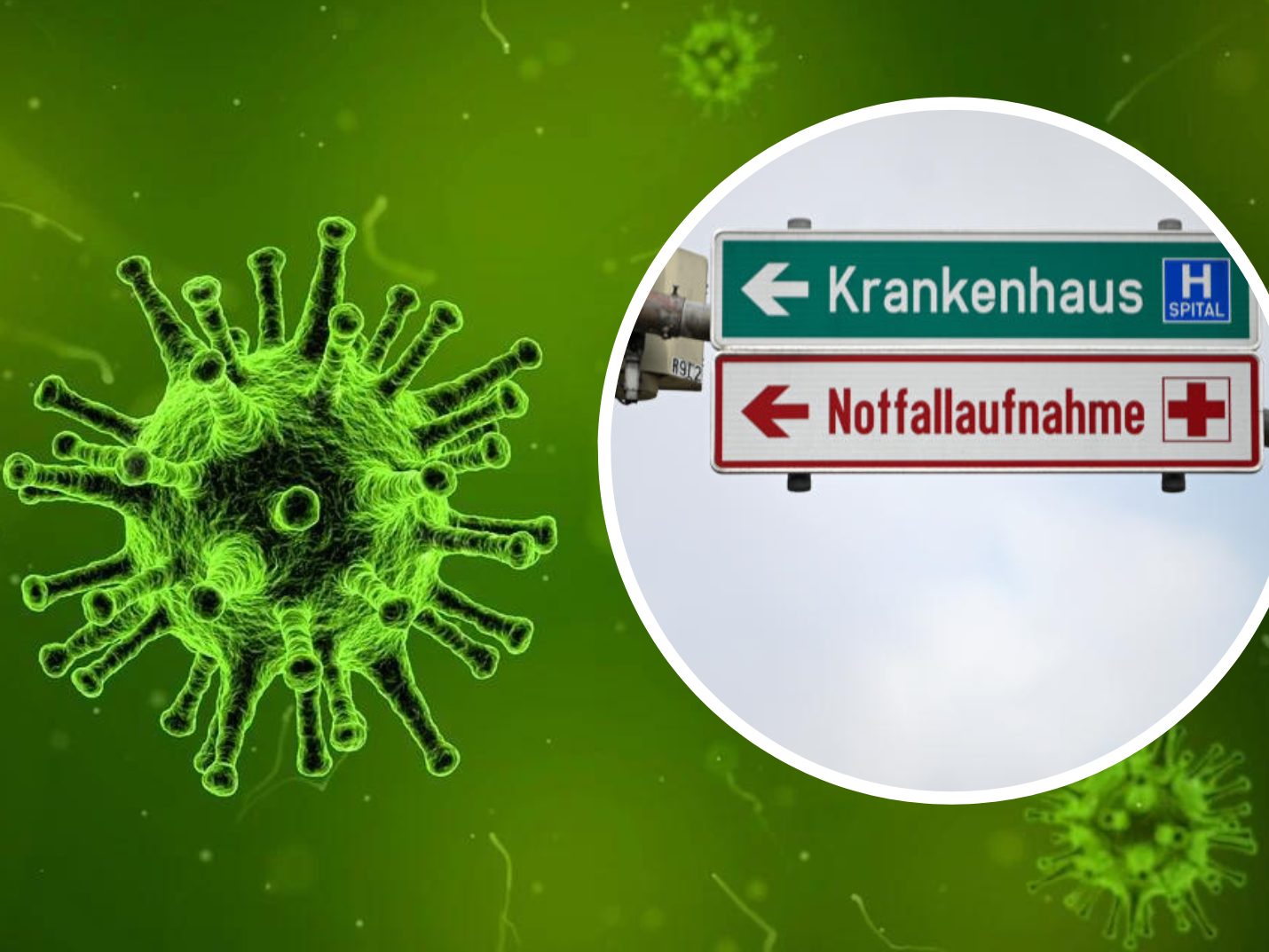 28 Prozent der heurigen Masernfälle wurden hospitalisiert.