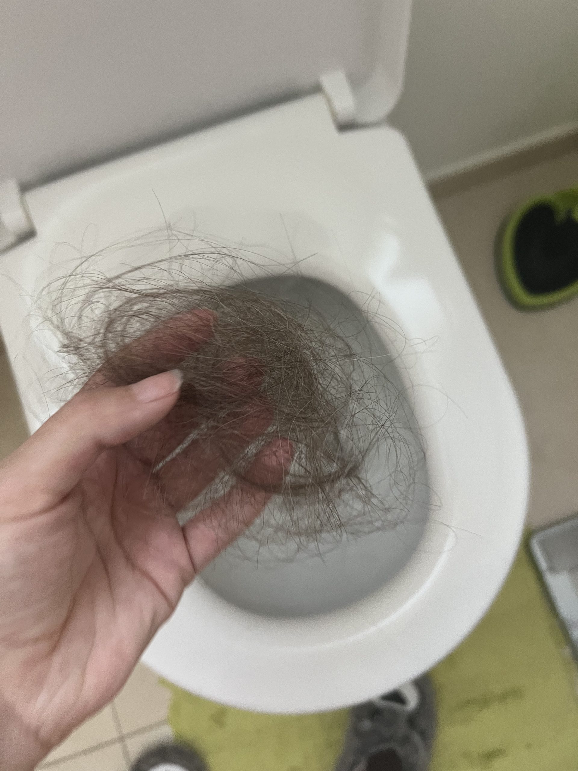 Ihre Haare fielen ihr etwa zwei Wochen nach der ersten Chemo aus. Ihre Haare fielen ihr etwa zwei Wochen nach der ersten Chemo aus.