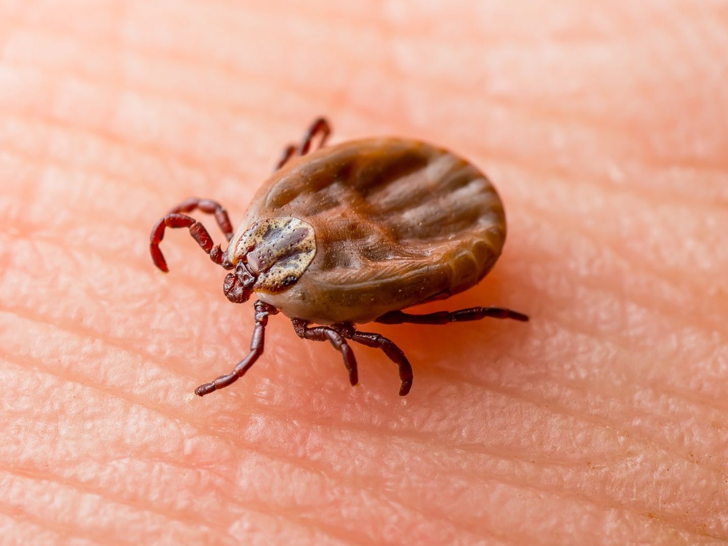 Diese Symptome weisen auf Borreliose oder FSME hin.