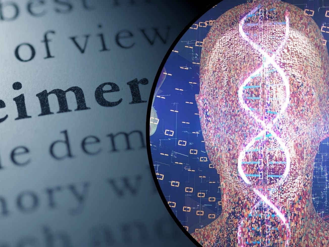 Forscher vermelden einen Durchbruch in der Alzheimer-Forschung.