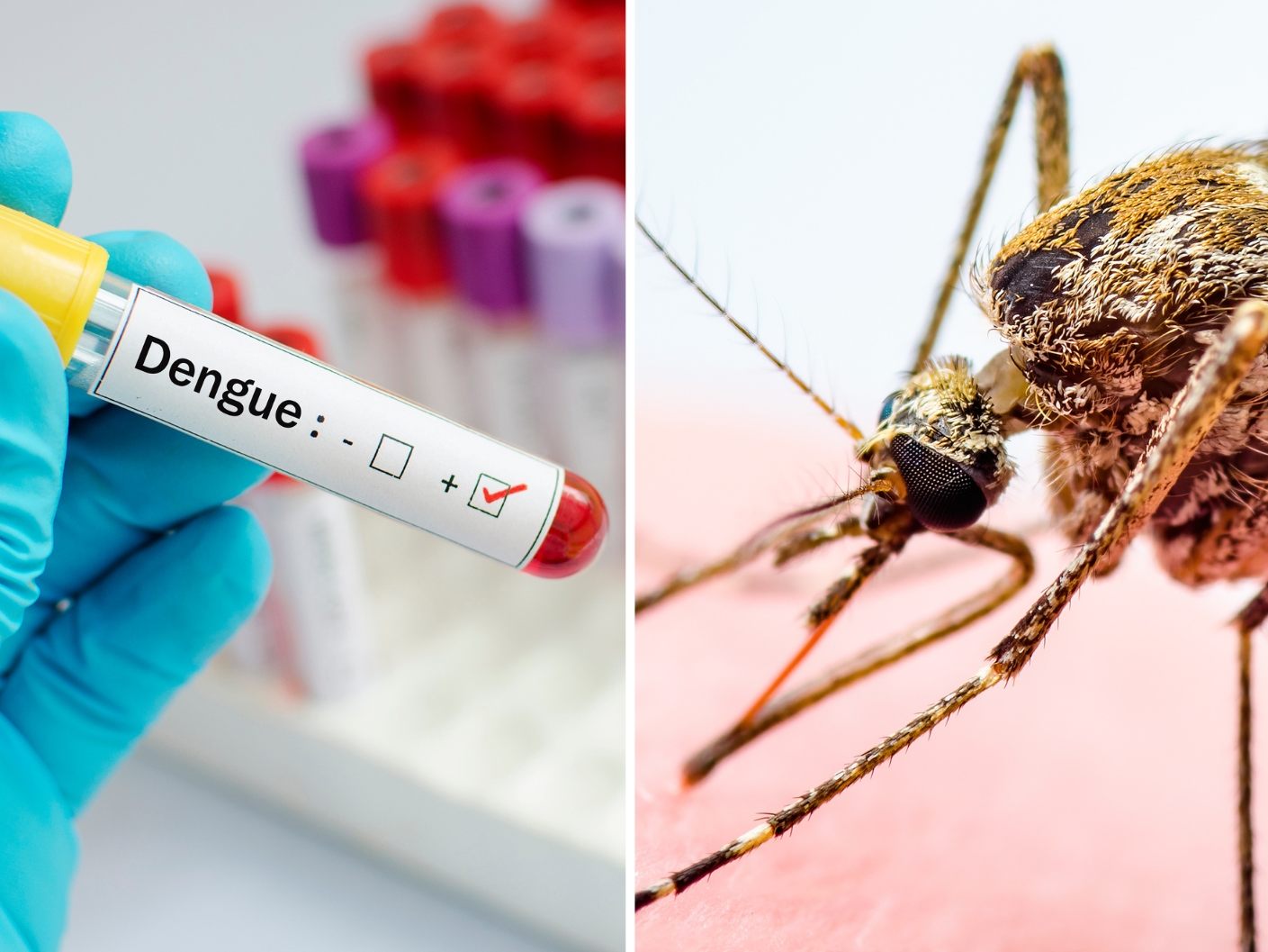 Die Zahl der Infektionen steige schon seit fünf Jahren, aber seit Anfang 2024 sei die Lage auf den amerikanischen Kontinenten besonders besorgniserregend, berichtete die WHO. (Symbolbild) Die Zahl der Infektionen steige schon seit fünf Jahren, aber seit Anfang 2024 sei die Lage auf den amerikanischen Kontinenten besonders besorgniserregend, berichtete die WHO. (Symbolbild)