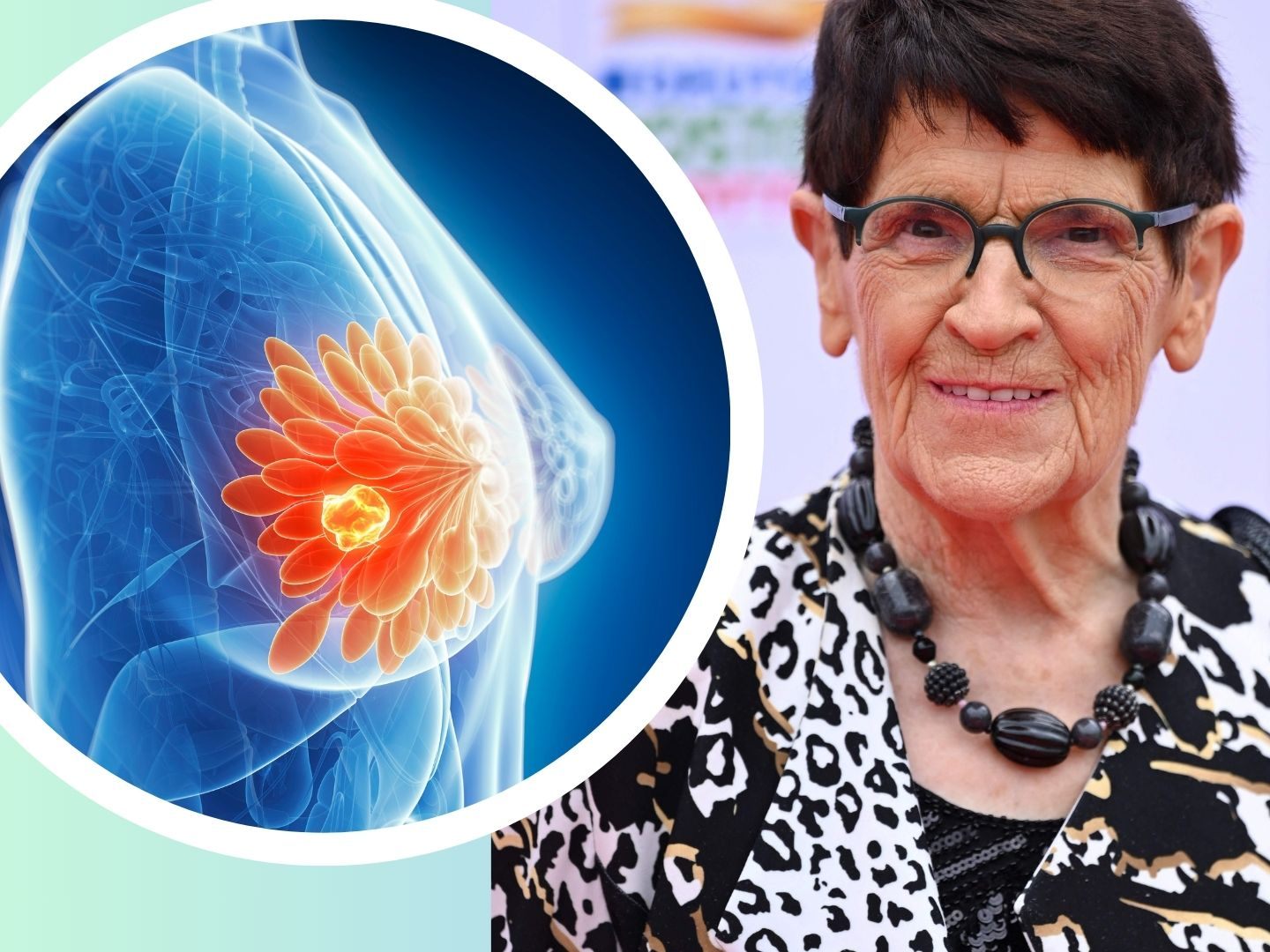 "Lasse mich nicht unterkriegen" - Rita Süssmuth hat Brustkrebs "Lasse mich nicht unterkriegen" - Rita Süssmuth hat Brustkrebs