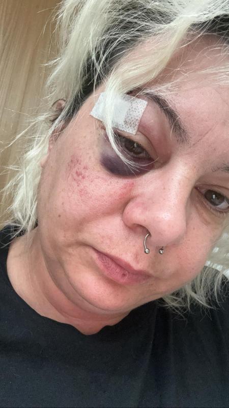 Jennifer hatte laut eigenen Angaben einen Arbeitsunfall auf dem Firmengelände. Jennifer hatte laut eigenen Angaben einen Arbeitsunfall auf dem Firmengelände.