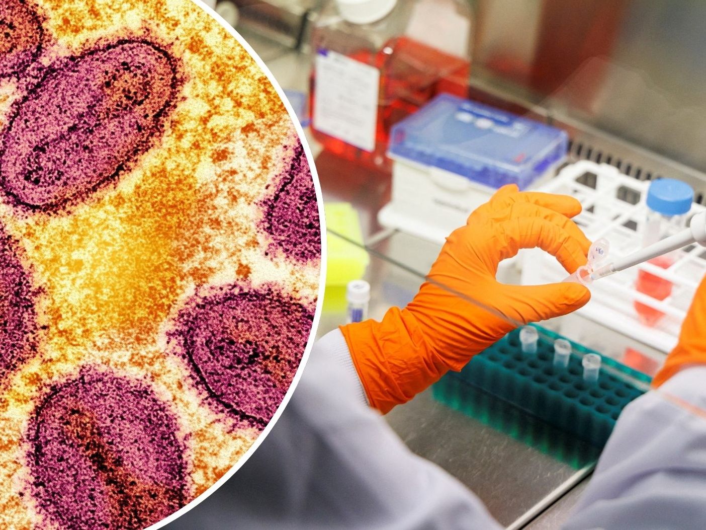 Im Nachbarland wurde erstmal die neue Variante des Mpox-Virus nachgewiesen. Im Nachbarland wurde erstmal die neue Variante des Mpox-Virus nachgewiesen.