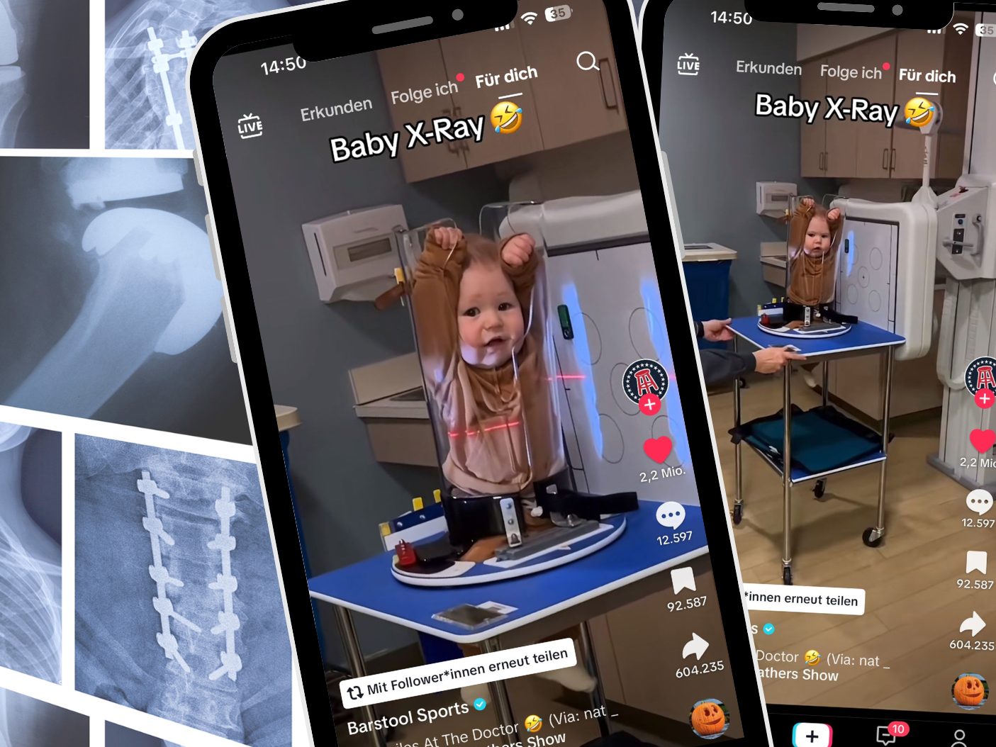 Ein TikTok-Video mit 2,5 Millionen Likes zeigt humorvolle Einblicke in eine Röntgenaufnahme, bei der ein Baby in einer speziellen Halterung positioniert wird.