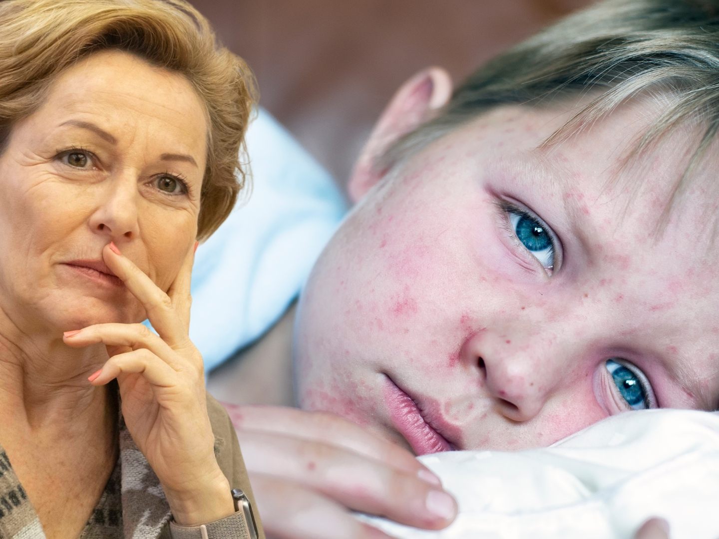 Gesundheitslandesrätin Martina Rüscher: Impfung schützt vor Masern. (Symbolbild) Gesundheitslandesrätin Martina Rüscher: Impfung schützt vor Masern. (Symbolbild)