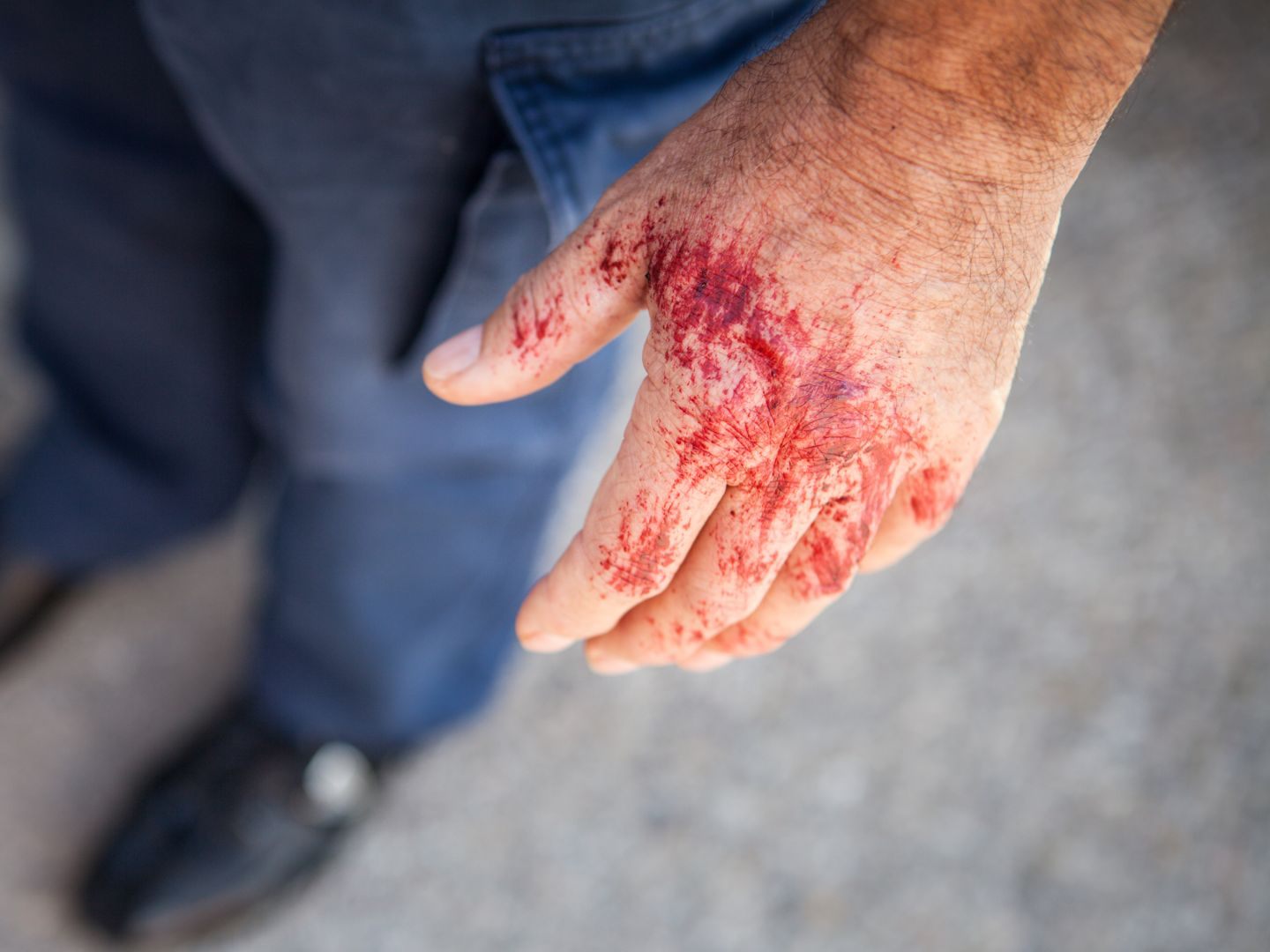 Das Pärchen hatte Blut an Händen und der Kleidung.
