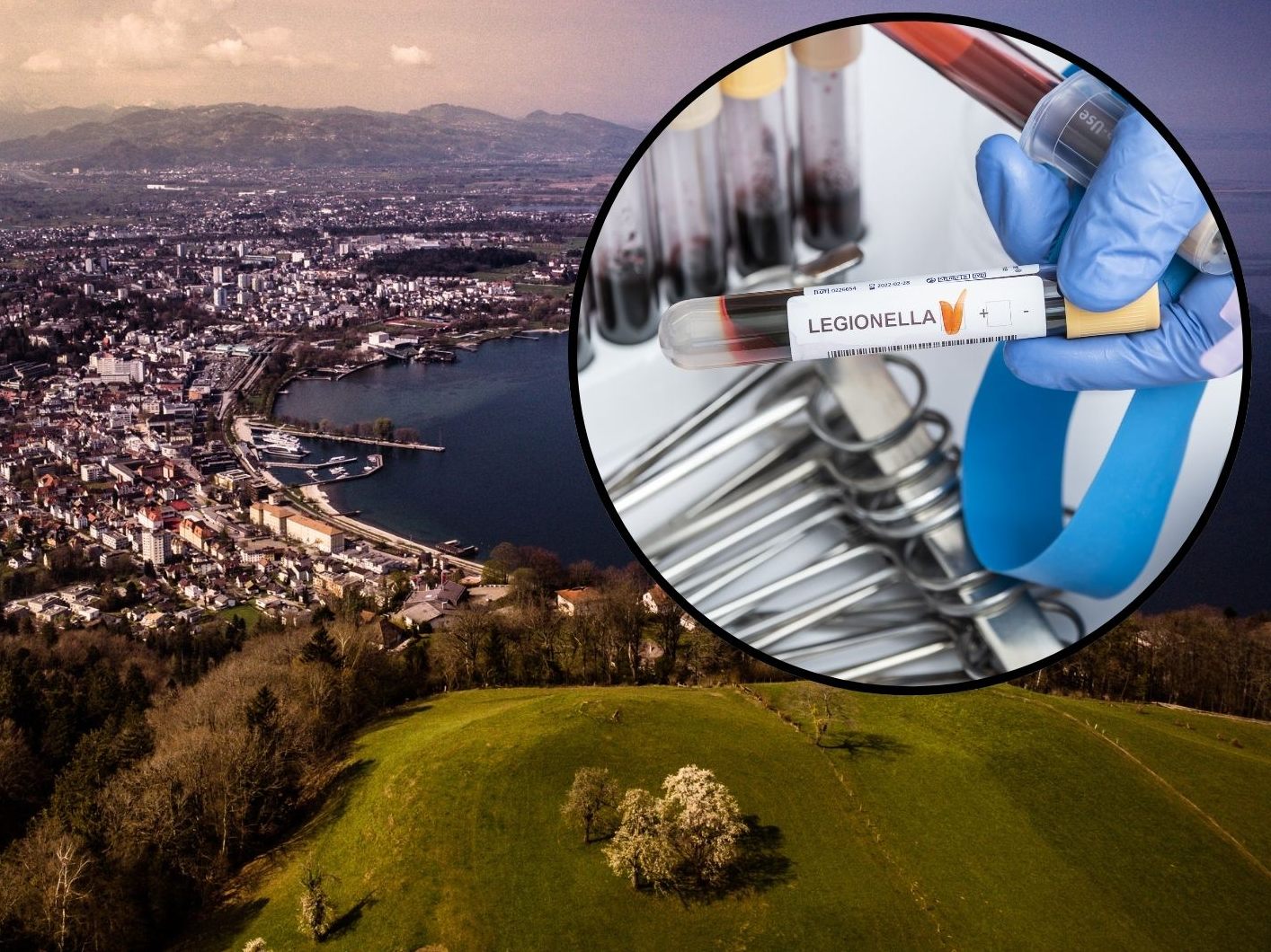 29 von 32 Fällen wurden im Unterland registriert. 29 von 32 Fällen wurden im Unterland registriert.