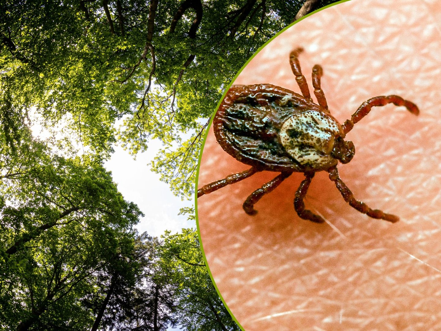 Die Gefahr von Zeckenbissen steigt bei milderen Temperaturen.