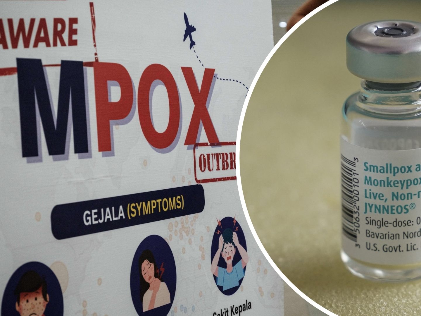 Schwache Gegenmaßnahmen lassen Epidemierisiko durch Mpox-Virus steigen.