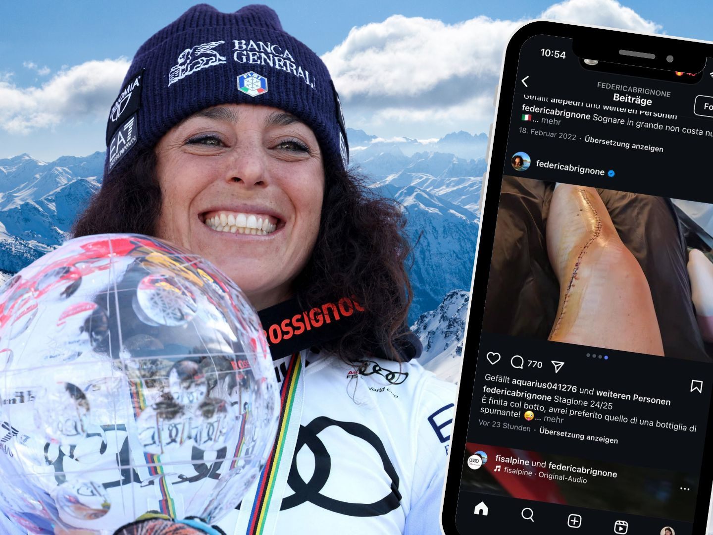 Federica Brignone zeigt nach ihrem Ski-Unfall eine auffällige OP-Narbe. Die 42 Stiche und eine ungewisse Genesung gefährden ihre Olympia-Teilnahme 2026.