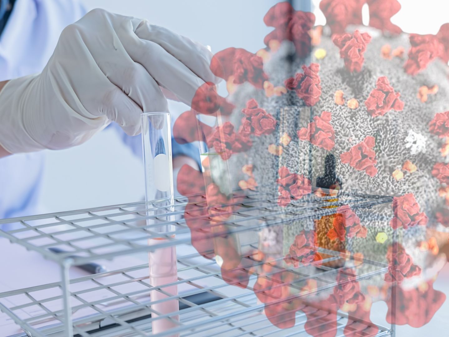 Das Protein Nsp1 hemmt bei einer Infektion mit einem Coronavirus die Produktion zelleigener Proteine.