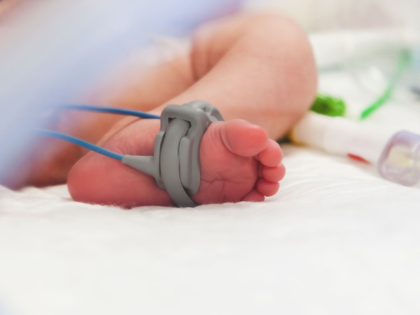 Ein Baby kämpft in Wien ums Überleben. Ein Baby kämpft in Wien ums Überleben.