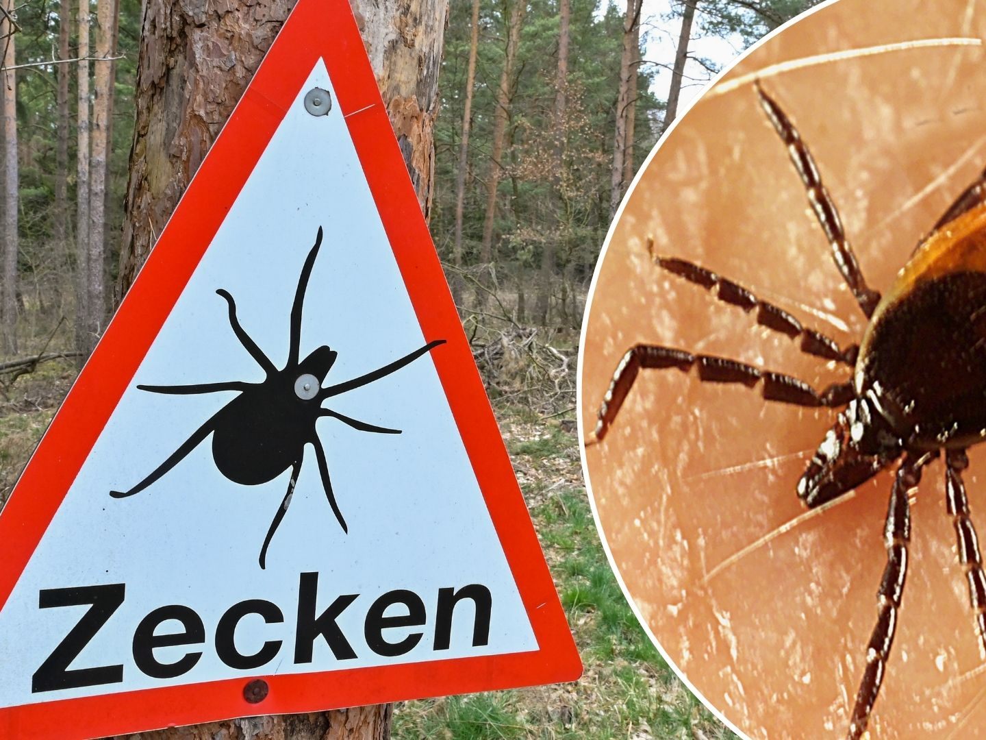 Gefährliche Zecken breiten sich in Österreich aus (SYMBOLBILD)