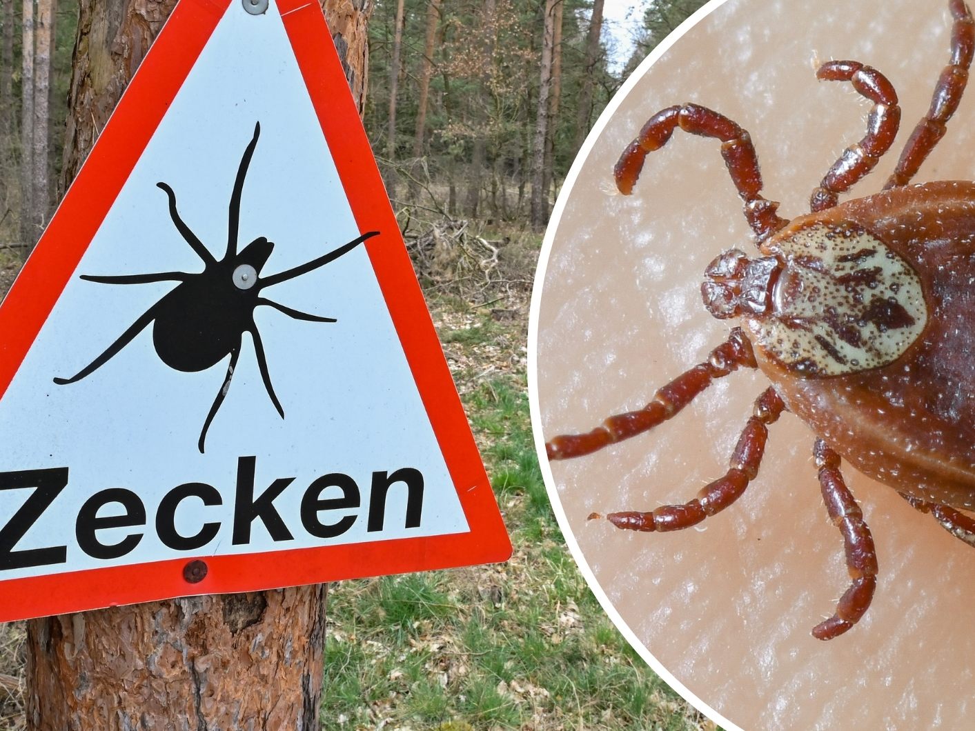 Zecken-Alarm auch in Vorarlberg: So schützen Sie sich vor FSME und Borreliose.