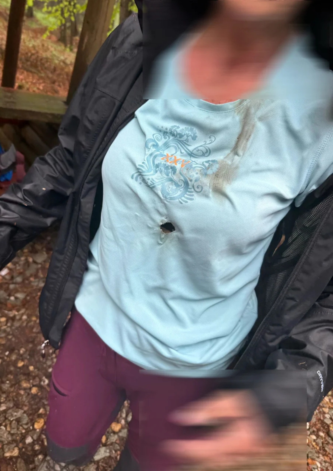 Die Frau wurde mitten in der Brust vom Blitz getroffen. Die Frau wurde mitten in der Brust vom Blitz getroffen.