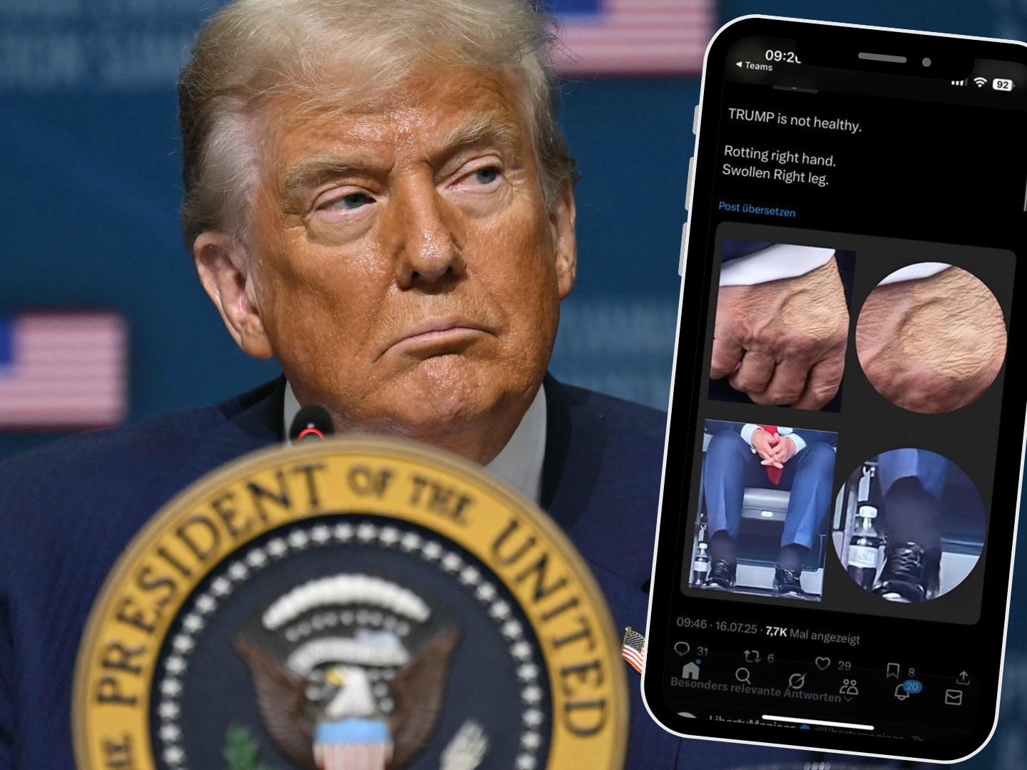 Geheimnis gelüftet: Das steckt wirklich hinter Trumps Flecken!