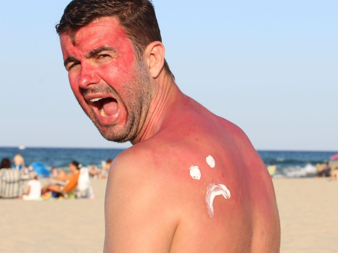 Sonne zu stark? Diese SOS-Tipps helfen sofort bei Sonnenbrand.