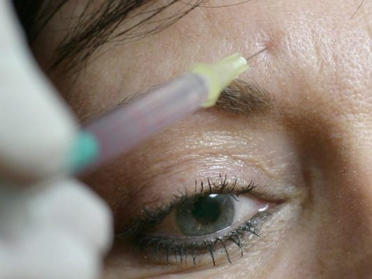 Angeklagte in Wels soll illegal Botox gespritzt haben Angeklagte in Wels soll illegal Botox gespritzt haben